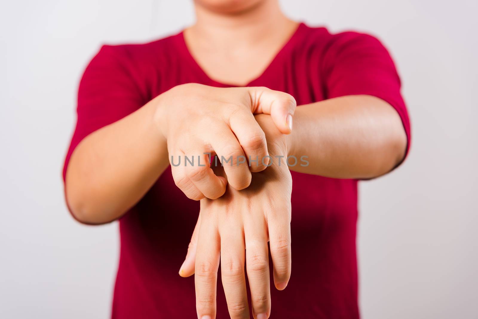 Asian beautiful woman itching her scratching her itchy arm on white background with copy space, Medical and Healthcare concept