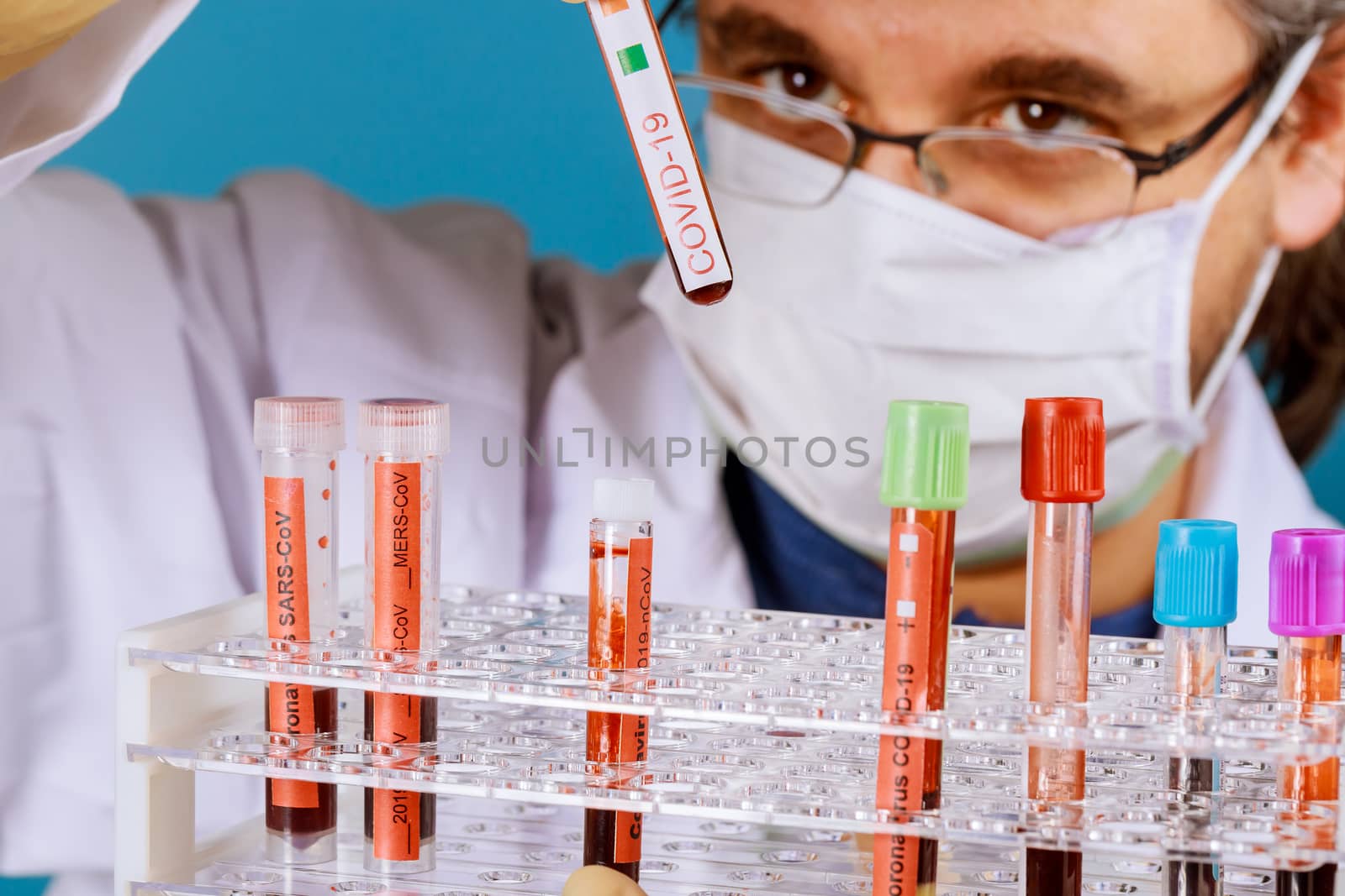Doctor holds in his hands blood samples COVID-19 Corona Virus is world wide