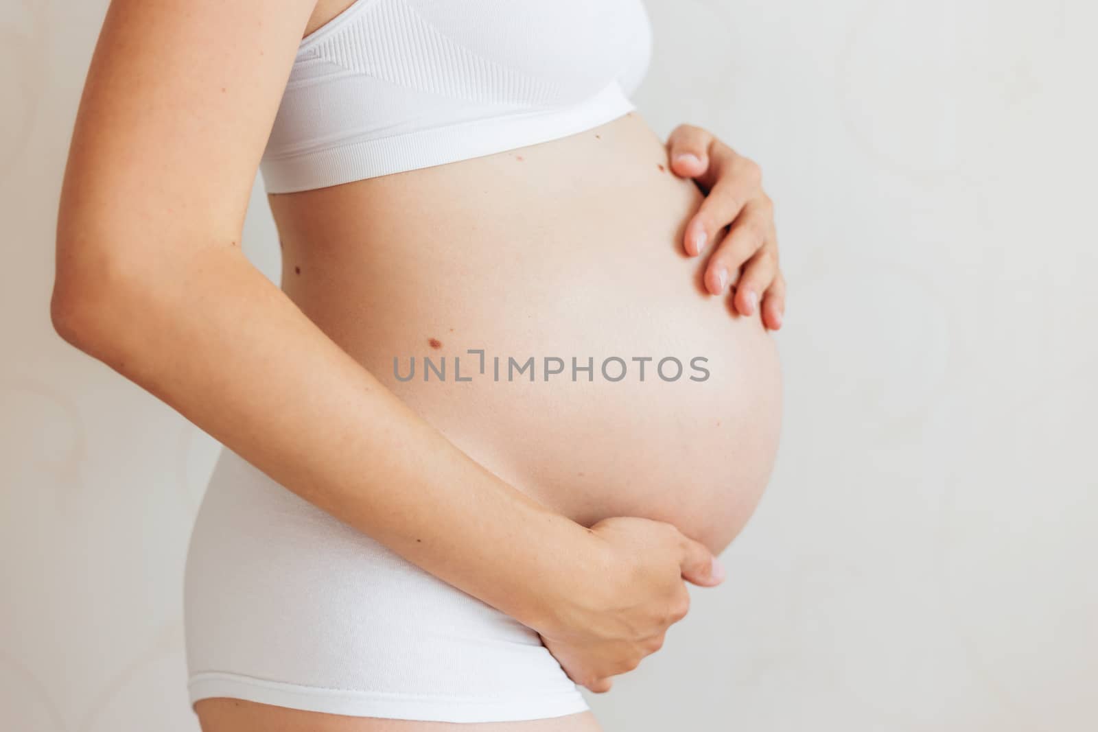 Pregnant woman with many birthmarks (nevus) in white underwear. Young woman expecting a baby.