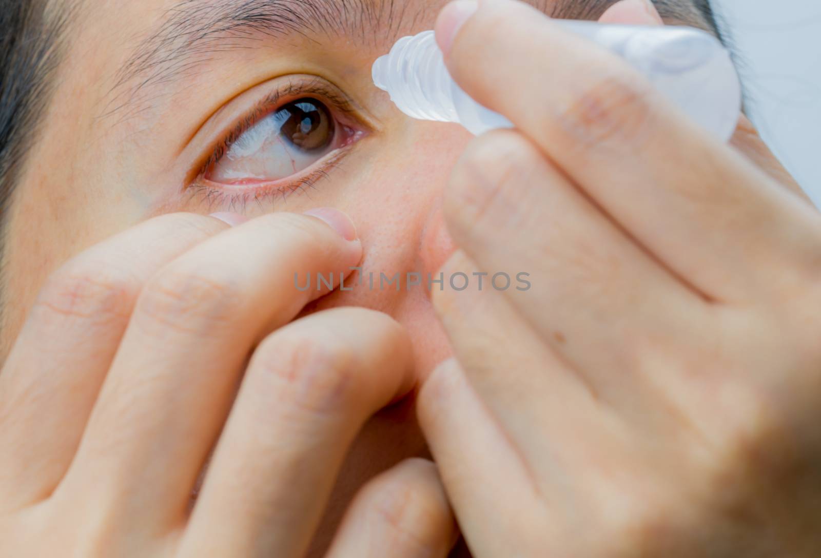 Adult Asian woman applying eye drops in her brown eyes. Eye care by Fahroni