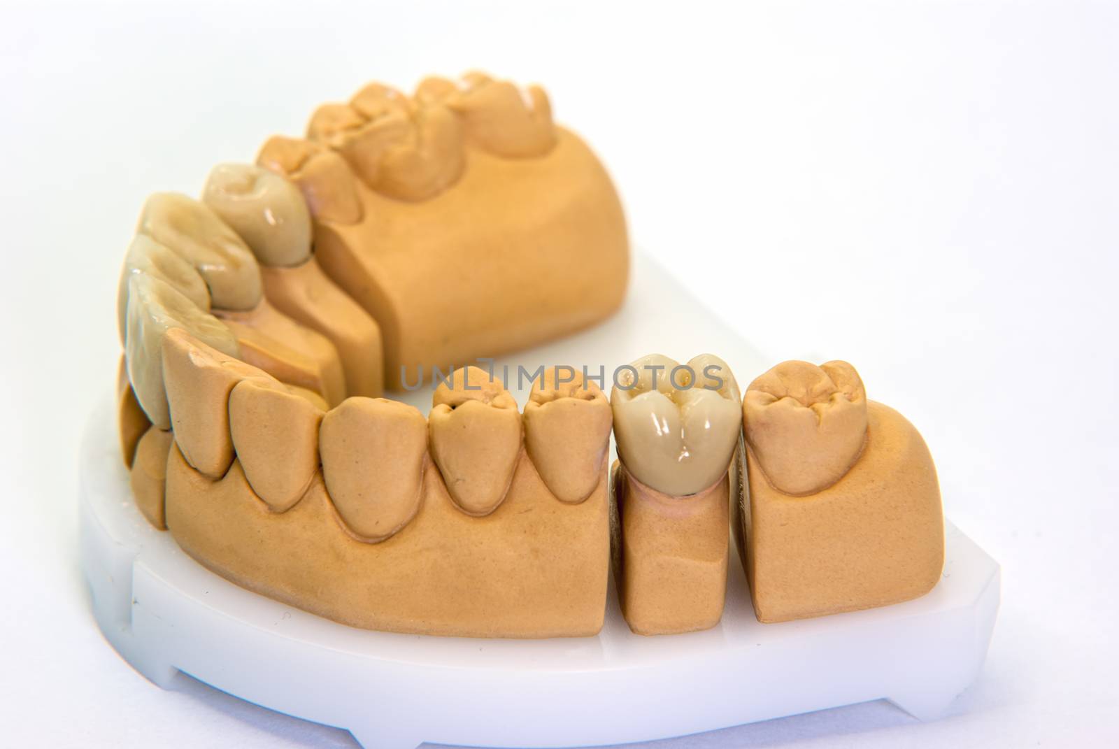 Dentist laborator, porcelain teeth on the model