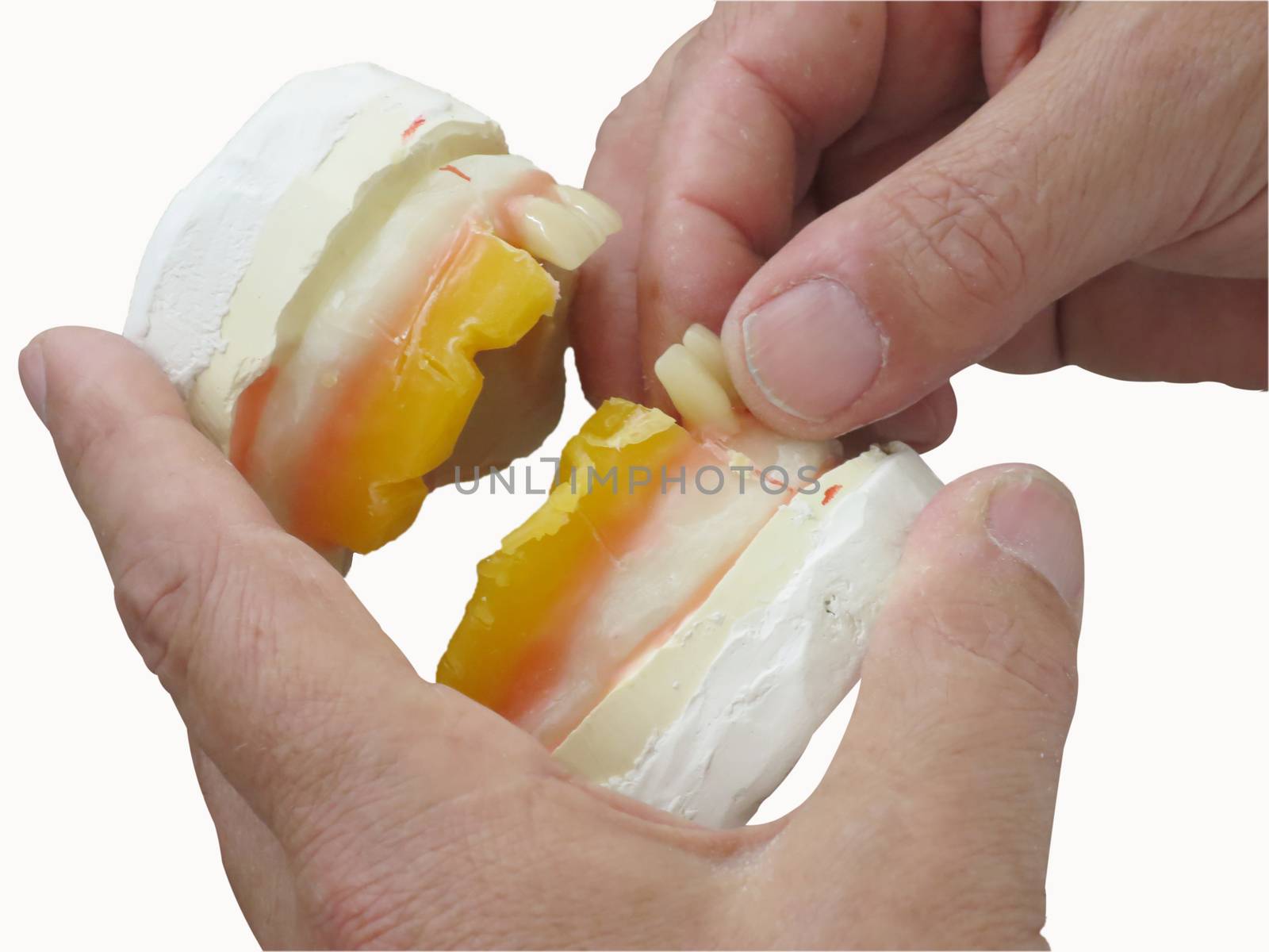 specialized hands that shape a plaster denture by alto190