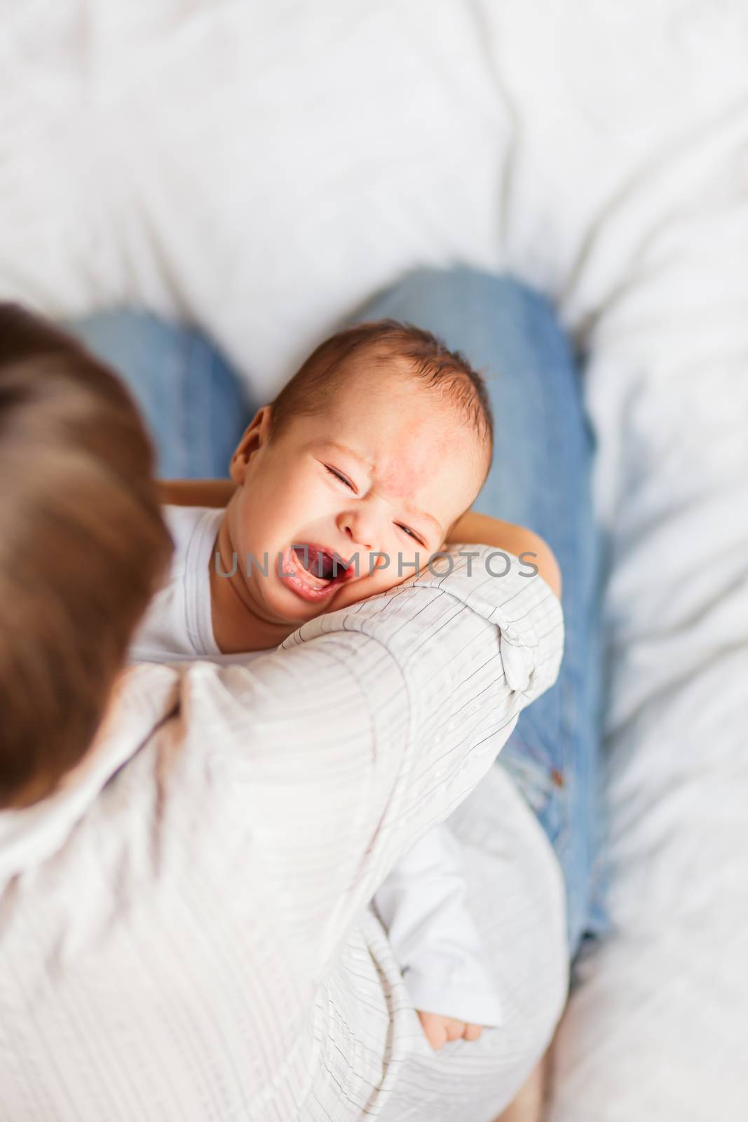 Woman holding a crying child. Mother comforts her little son or daughter. Baby with a big birthmark on his forehead.