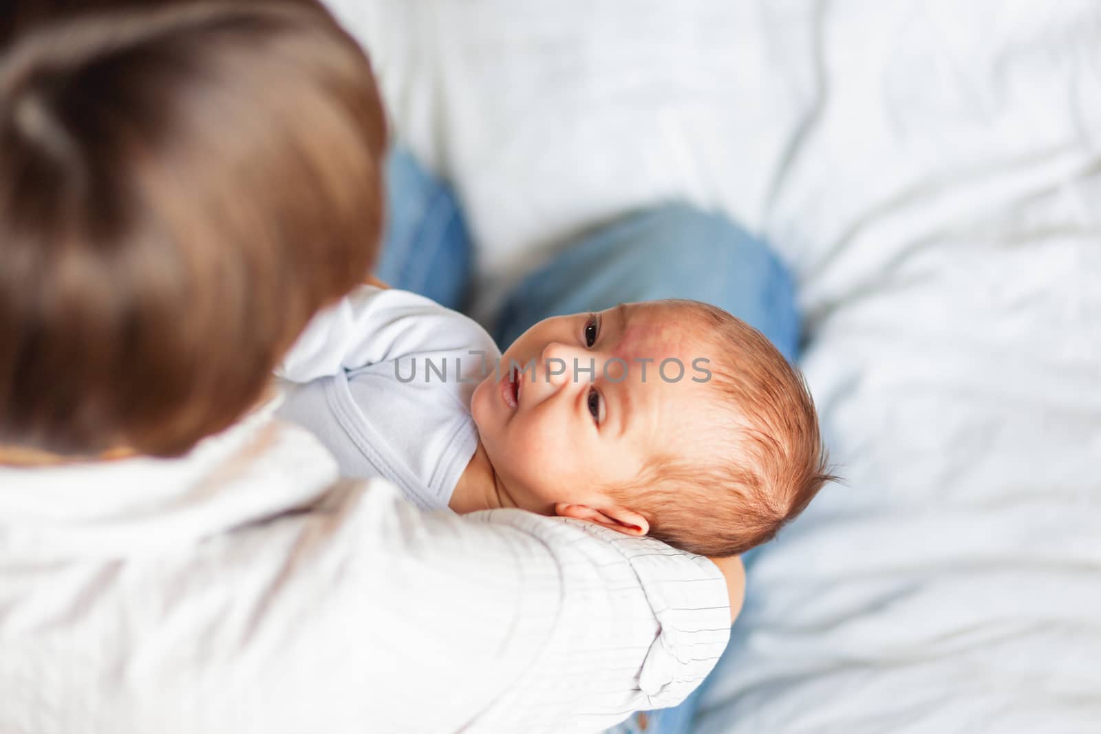 Woman holding her child. Mother comforts her little son or daughter. Baby with a big birthmark on his or her forehead.