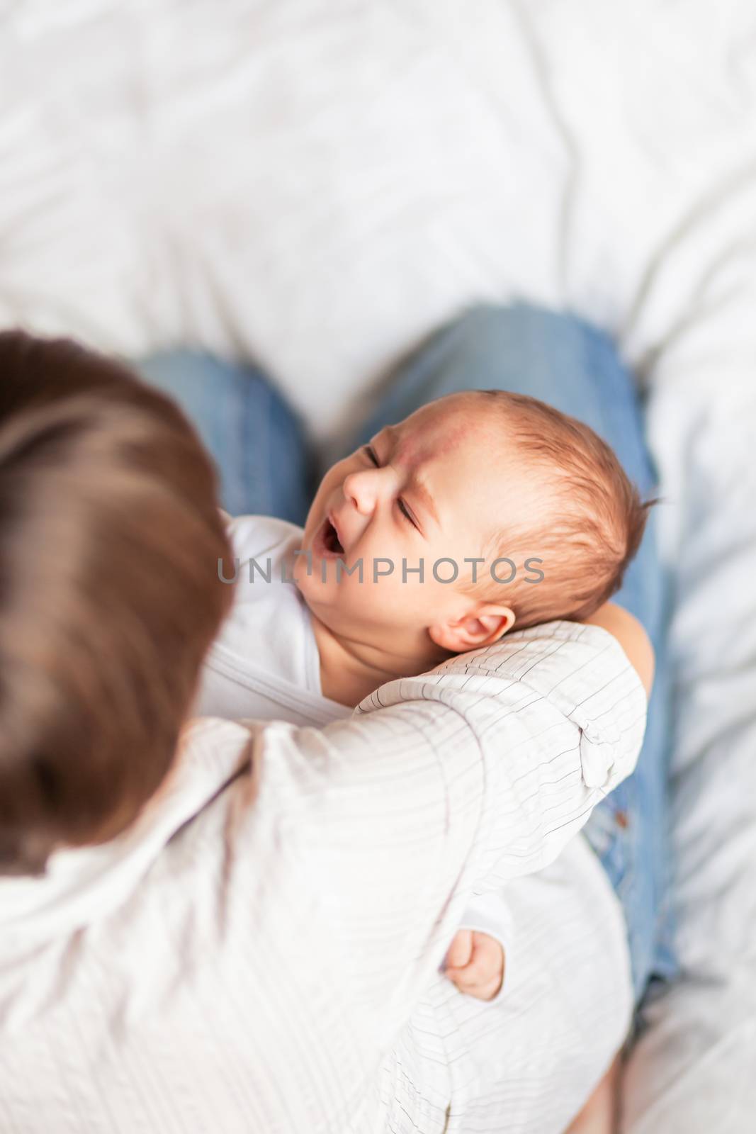 Woman holding a crying child. Mother comforts her little son or daughter. Baby with a big birthmark on his forehead.