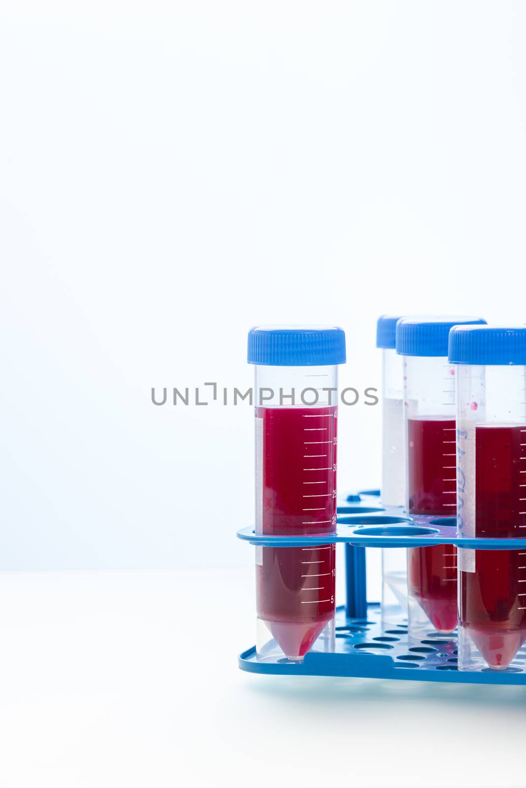Blood Testing Samples in Laboratory. Covid-19 Blood Test Concept.