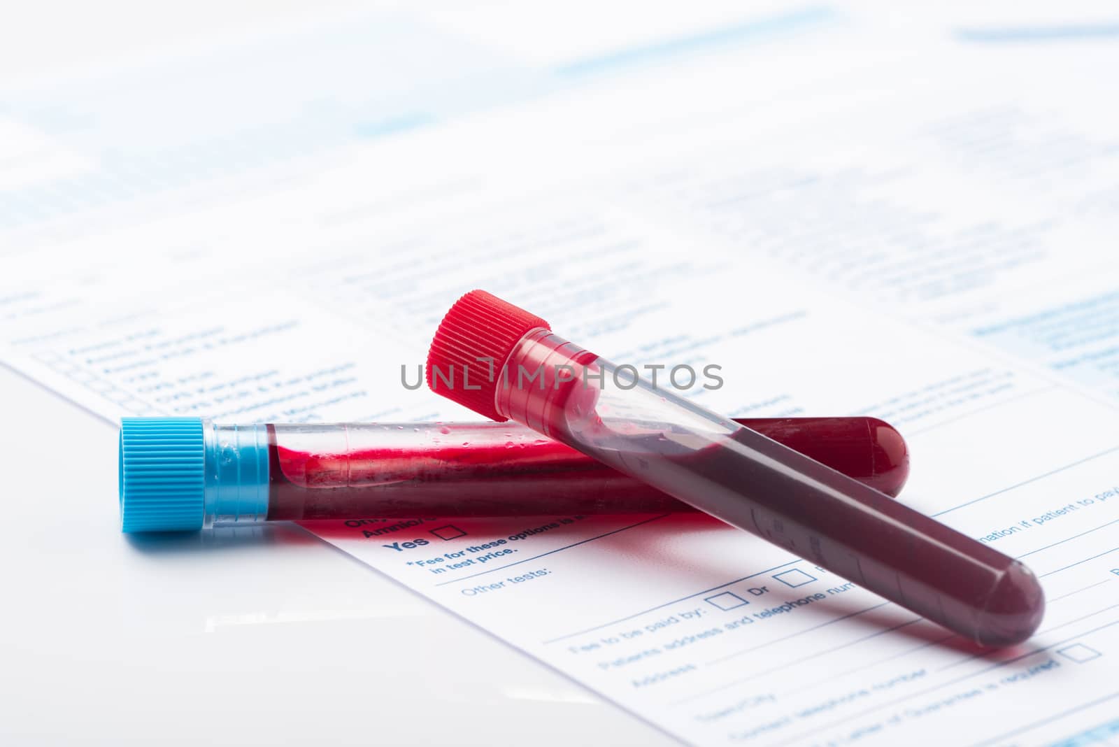 Laboratory Testing Patient’s Blood Samples for Presence of Coronavirus (COVID-19).  Test Tube Containing a Blood Sample on Doctor Table.