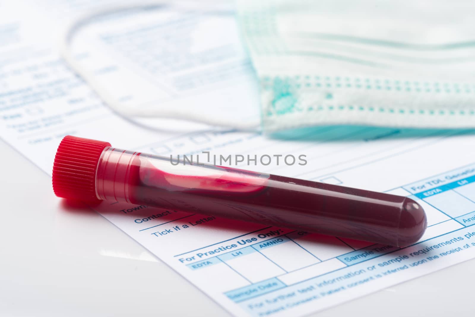 Laboratory Testing Patient’s Blood Samples for Presence of Coronavirus (COVID-19).  Test Tube Containing a Blood Sample on Doctor Table.