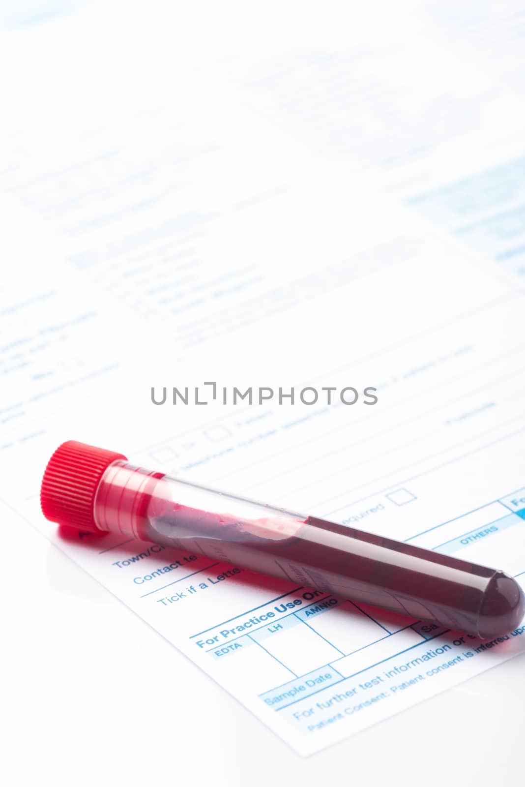 Blood Test Samples for Presence of Coronavirus (COVID-19) Tube Containing a Blood Sample from Patient.