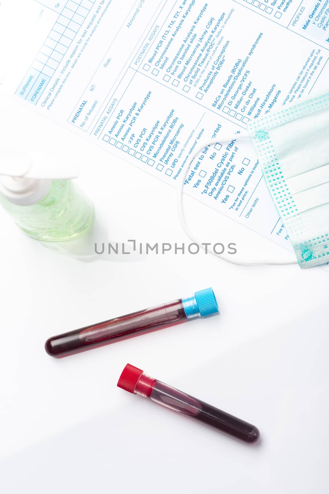 Blood Test Samples for Presence of Coronavirus (COVID-19) Tube Containing a Blood Sample from Patient.