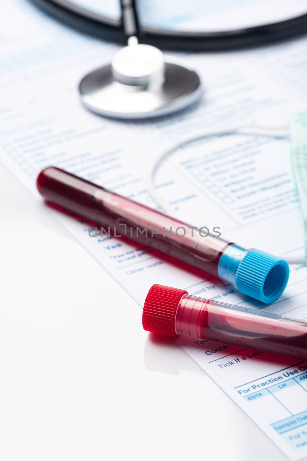 Blood Test Samples for Presence of Coronavirus (COVID-19) Tube Containing a Blood Sample from Patient.