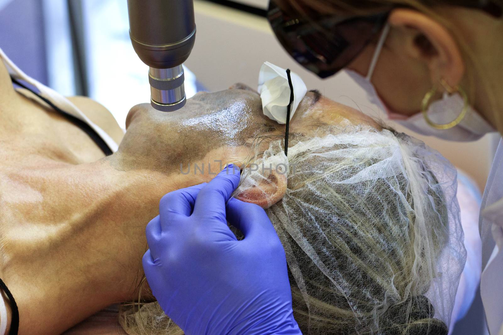 A medical professional makes a mask and laser cleansing and polishing of the skin of the face to the patient.