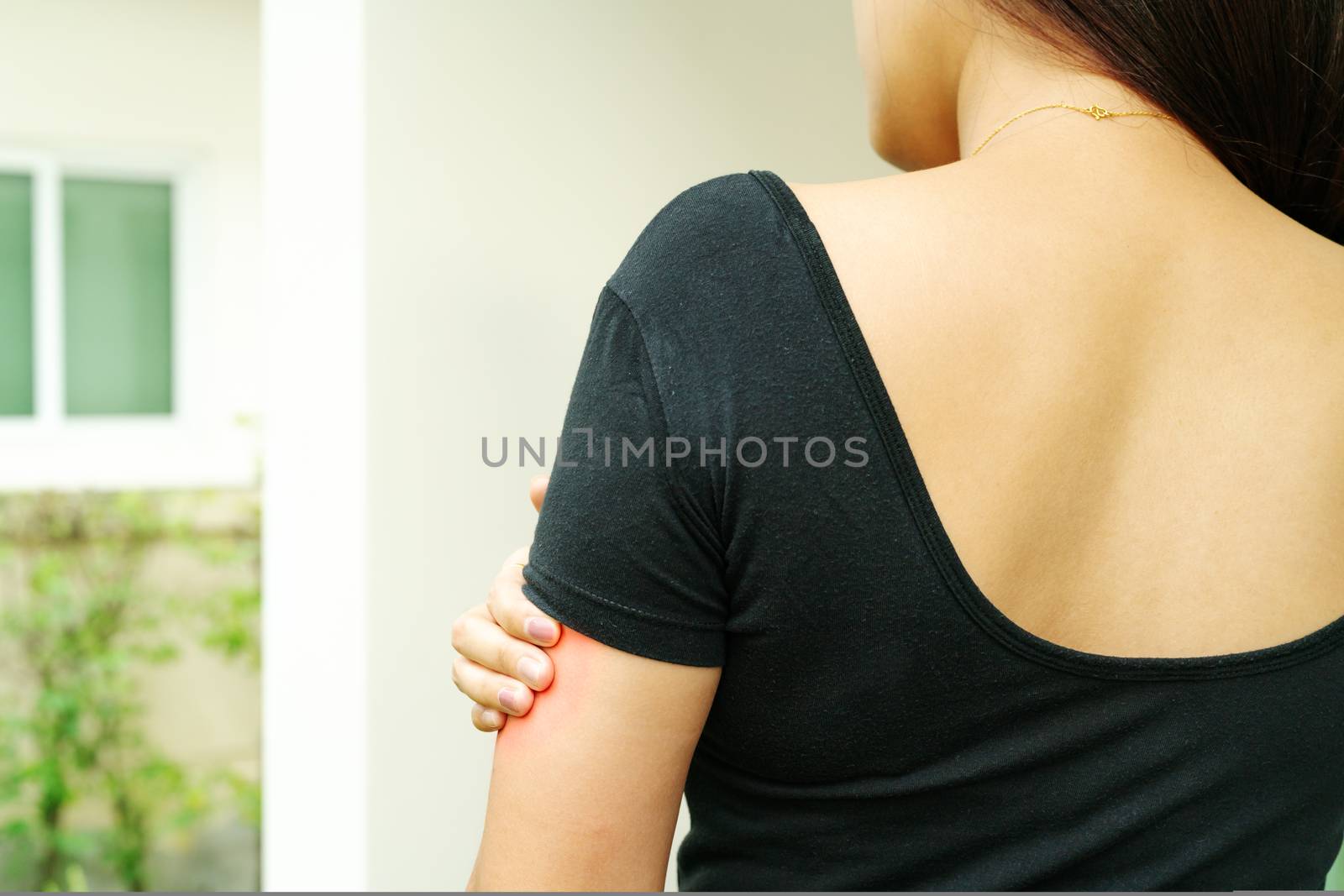 Women hand scratch the itch on arm, healthcare and medicine concept.