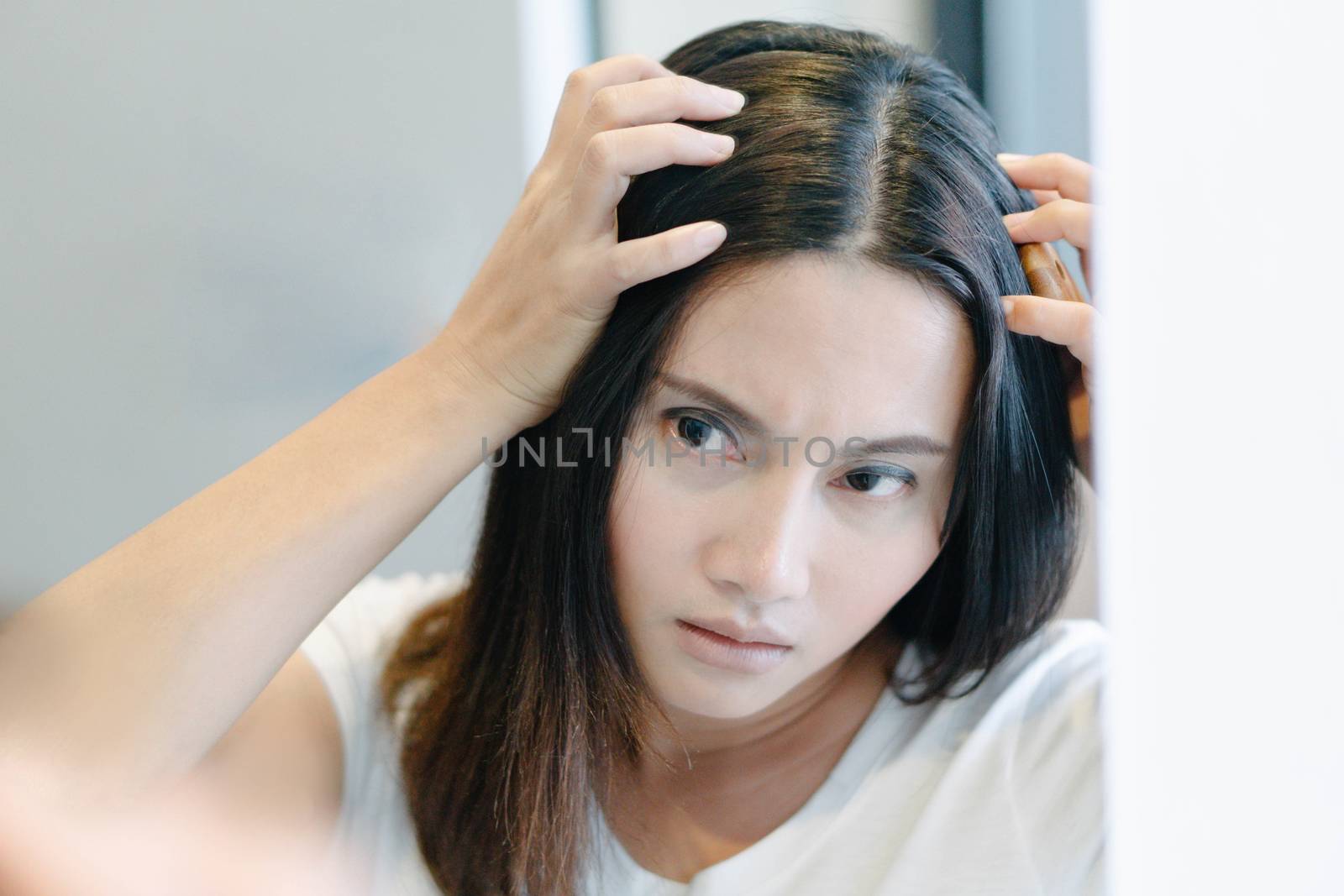 Woman serious hair loss problem for health care shampoo and beau by pt.pongsak@gmail.com