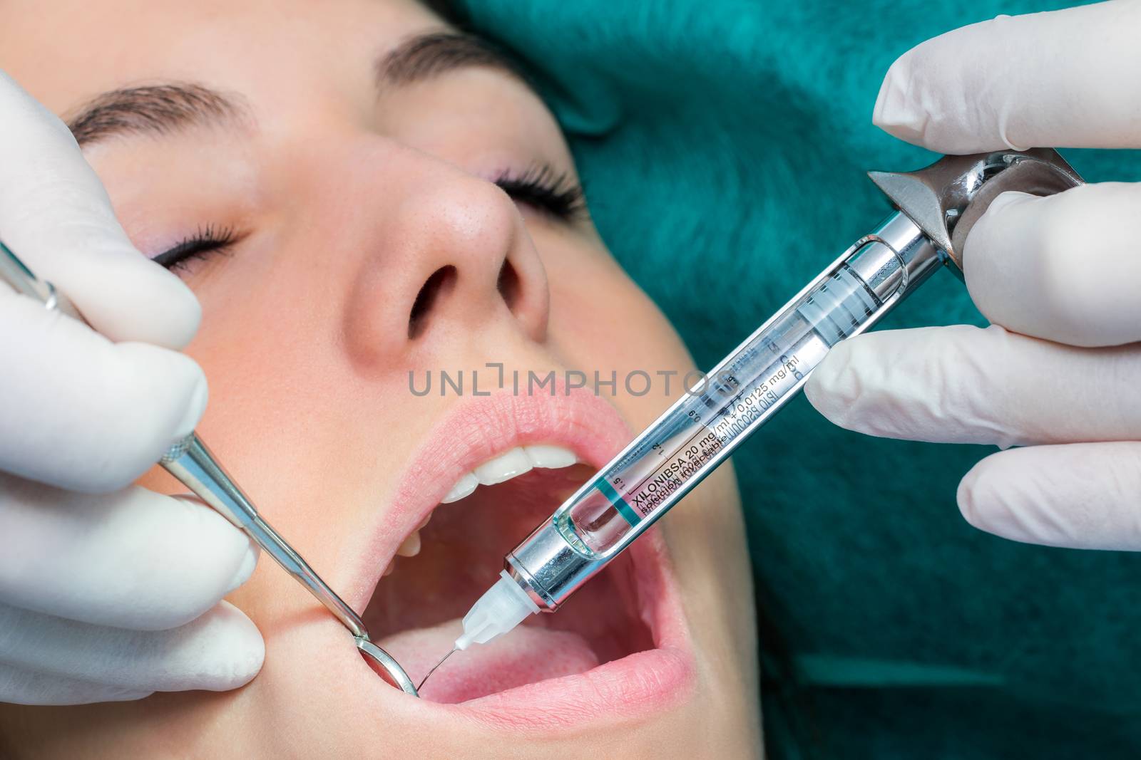 Macro close up of young girl receiving anesthesia with medical syringe.Dentist injecting needle in open mouth.