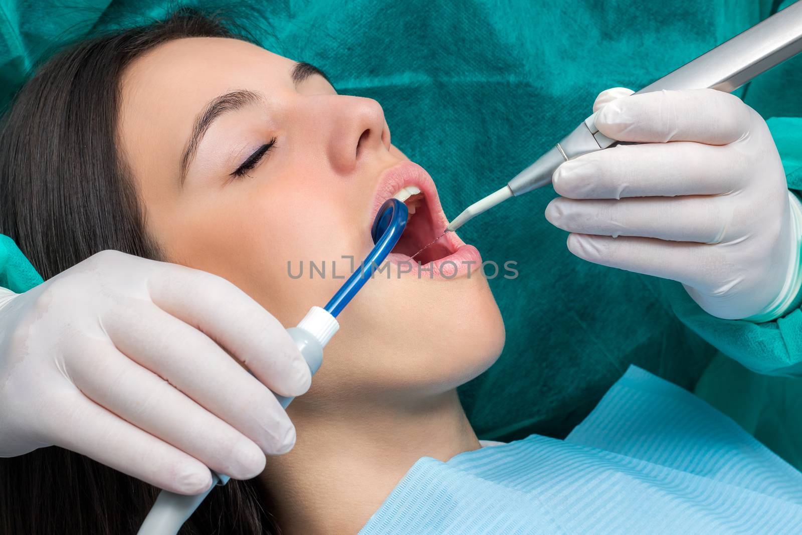 Close up macro face shot of young woman having dental cleaning.Hands wearing gloves working on teeth with saliva ejector and water cleaning unit.