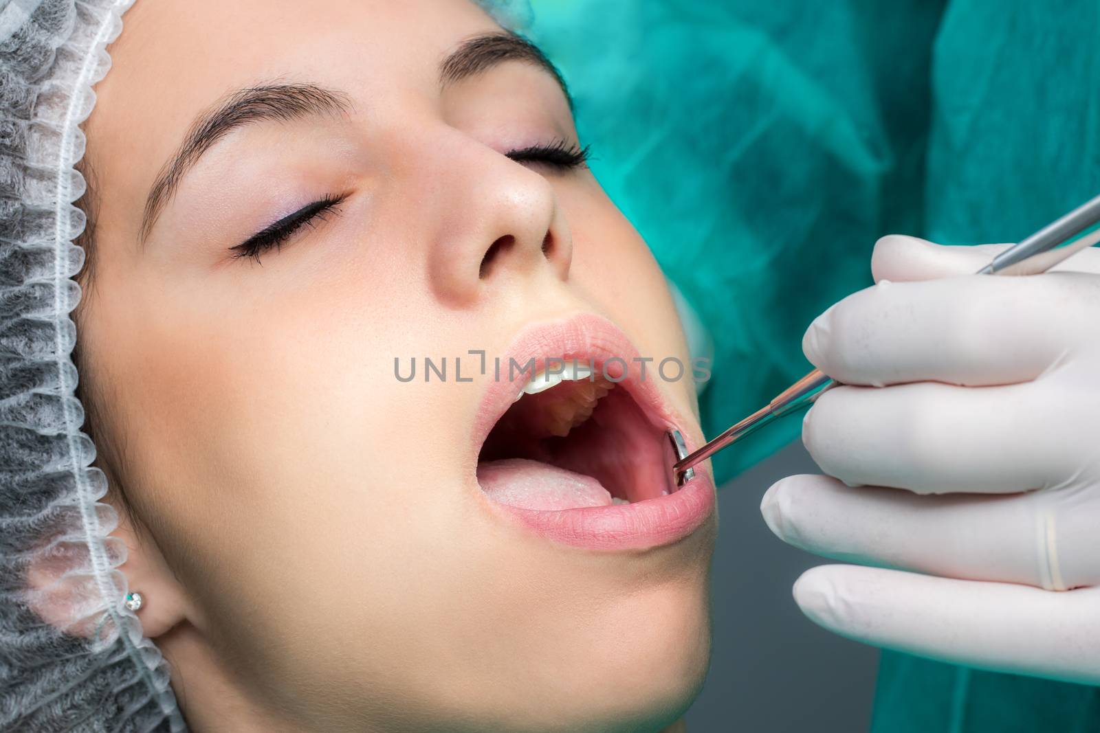 Woman having dental operation. by karelnoppe