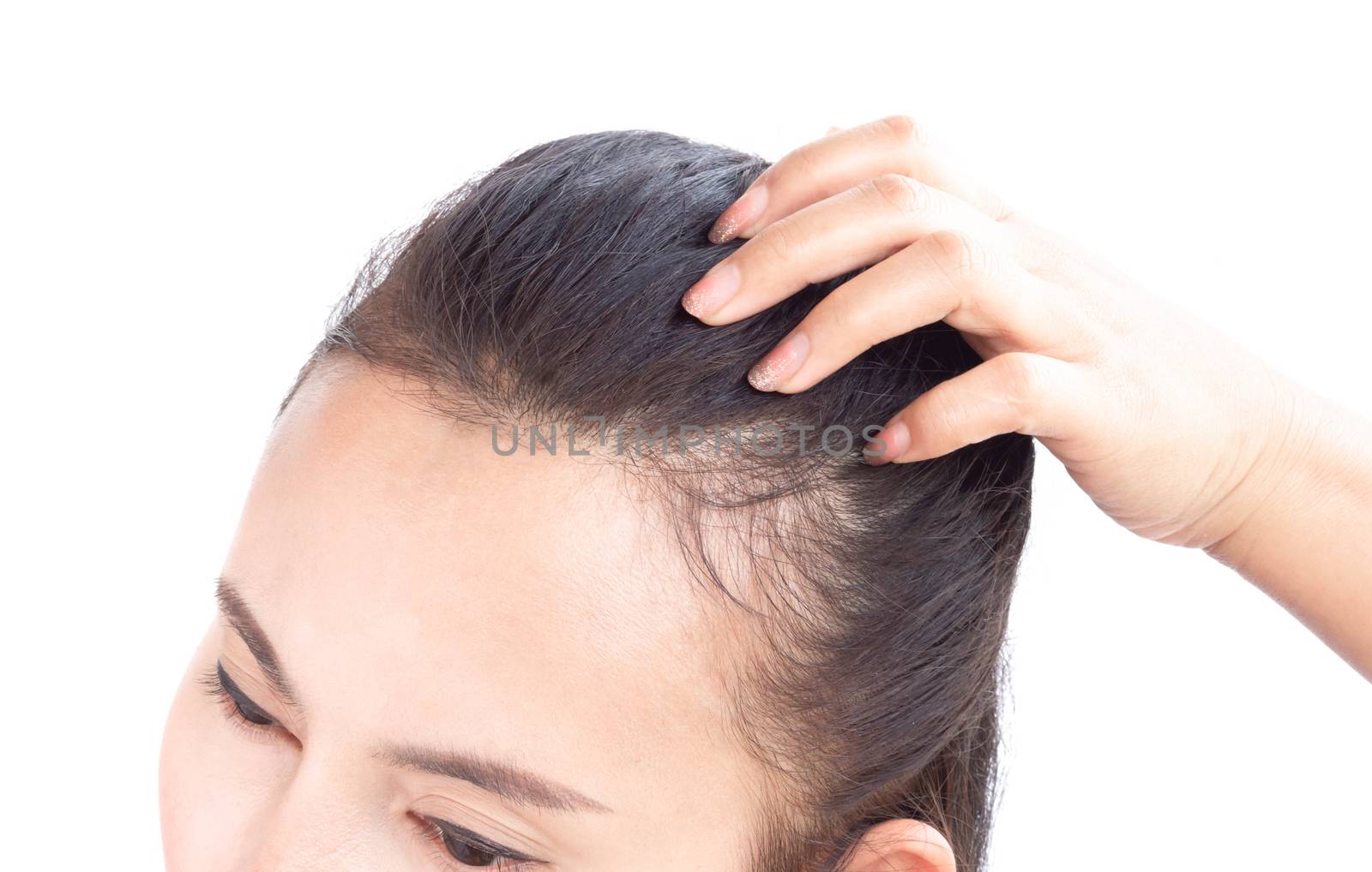 Woman serious hair loss problem for health care shampoo and beauty product concept, selective focus