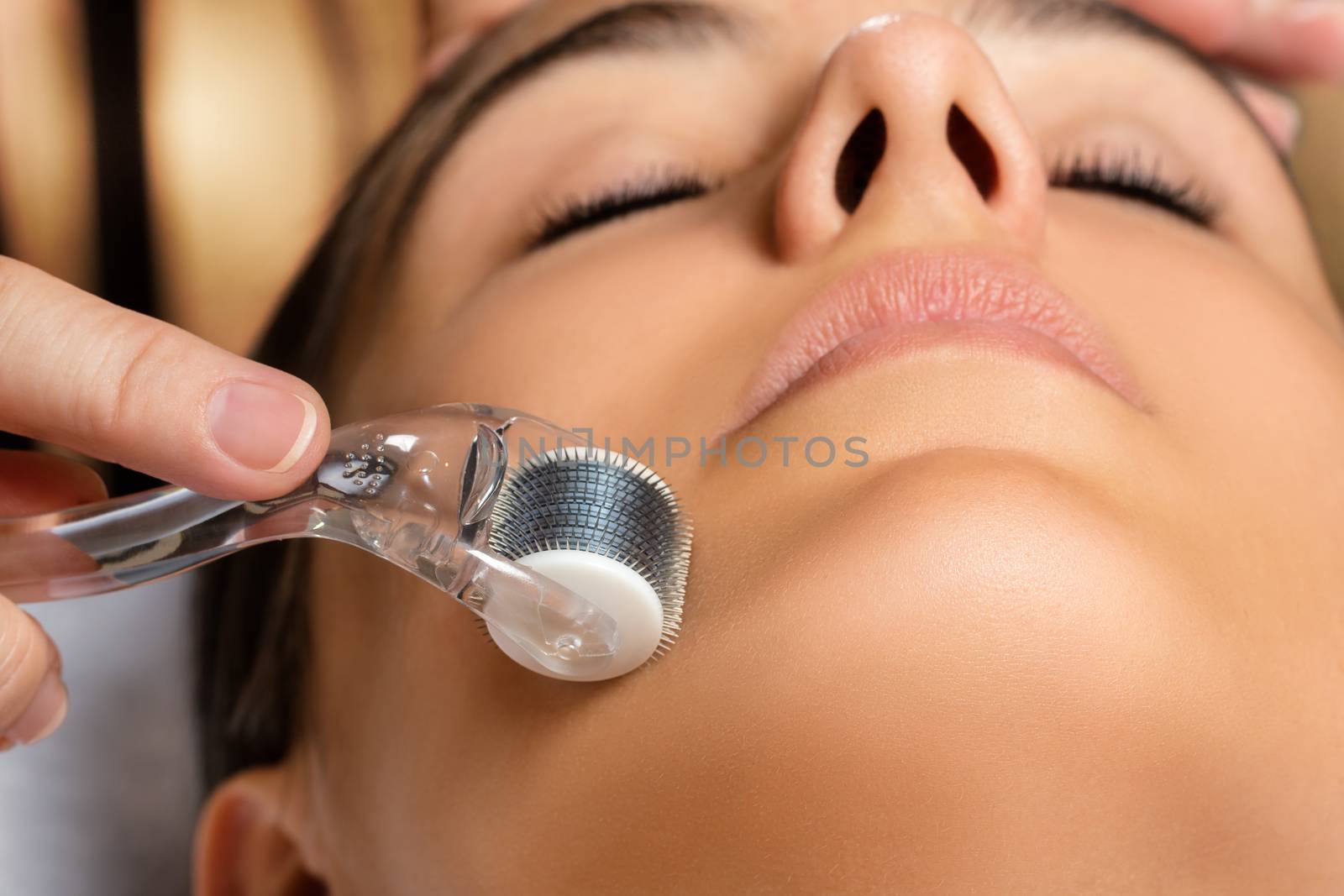 Macro close up portrait of woman having beauty skin tightening treatment.Therapist rolling with derma skin roller on female face.