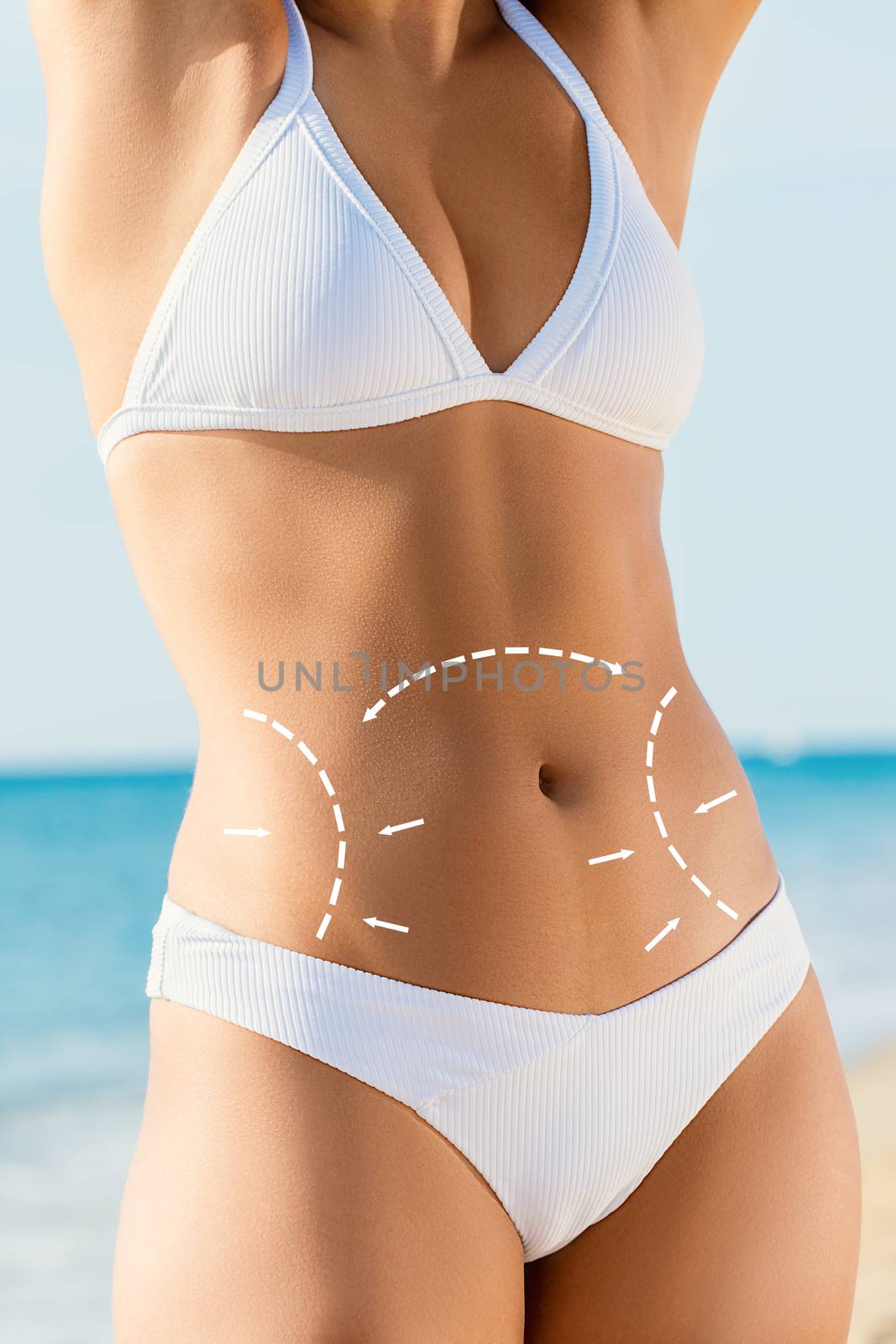 Close up detail of attractive female torso outdoors. Conceptual surgical incision contour lines highlighted on skin for liposuction.