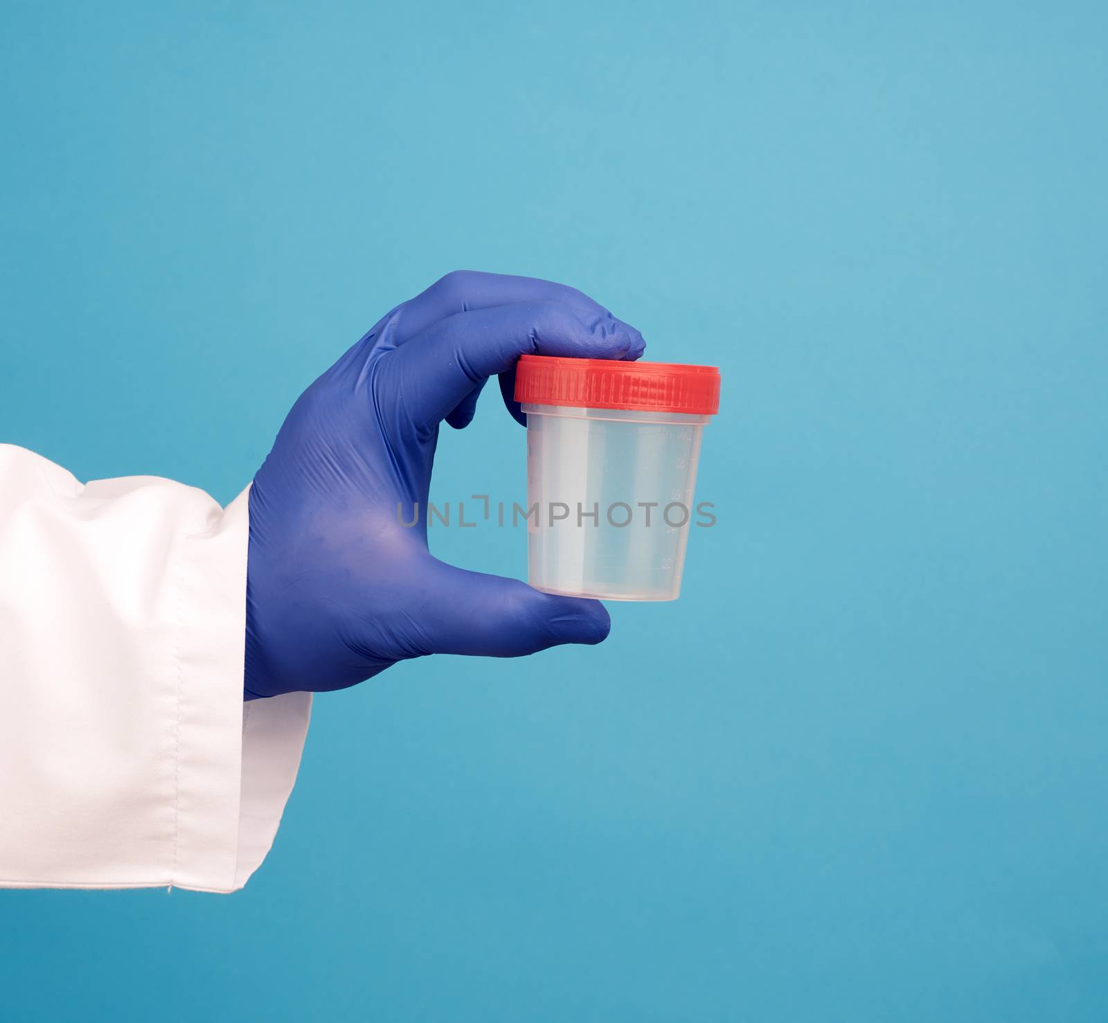 doctor in a white coat holds a empty plastic container for urine specimen, wearing blue sterile medical gloves
