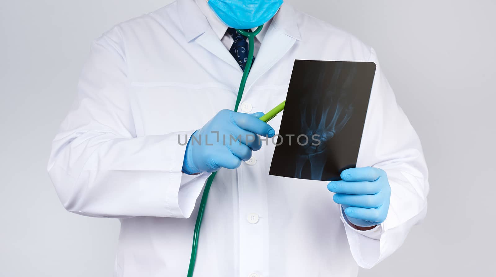 doctor in a white coat and blue latex gloves holds an x-ray of a man’s hand and conducts a visual examination, white background