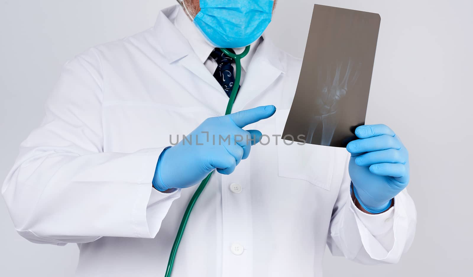 doctor in a white coat and blue latex gloves holds an x-ray of a man’s hand and conducts a visual examination, white background
