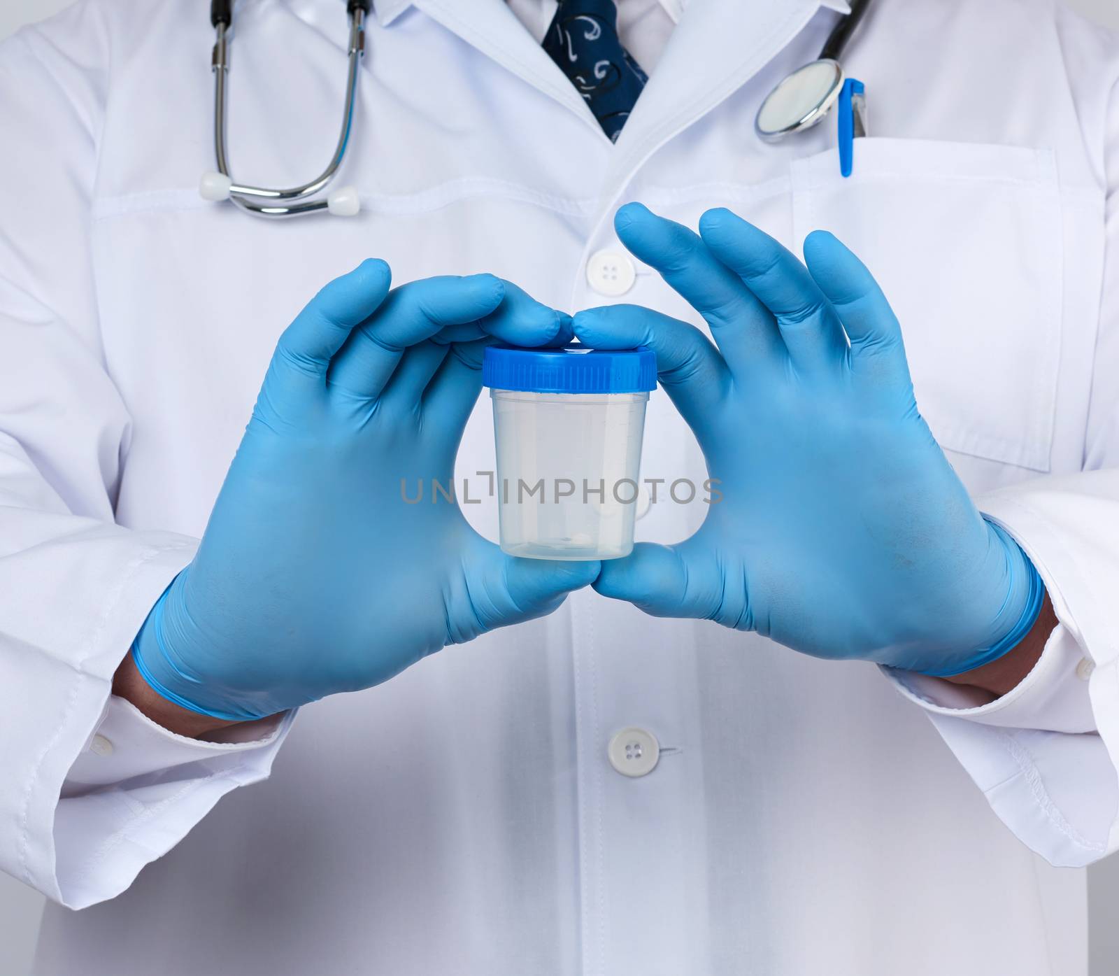 male doctor in a white coat and tie stands and holds a plastic container for urine specimen, wearing blue sterile medical gloves