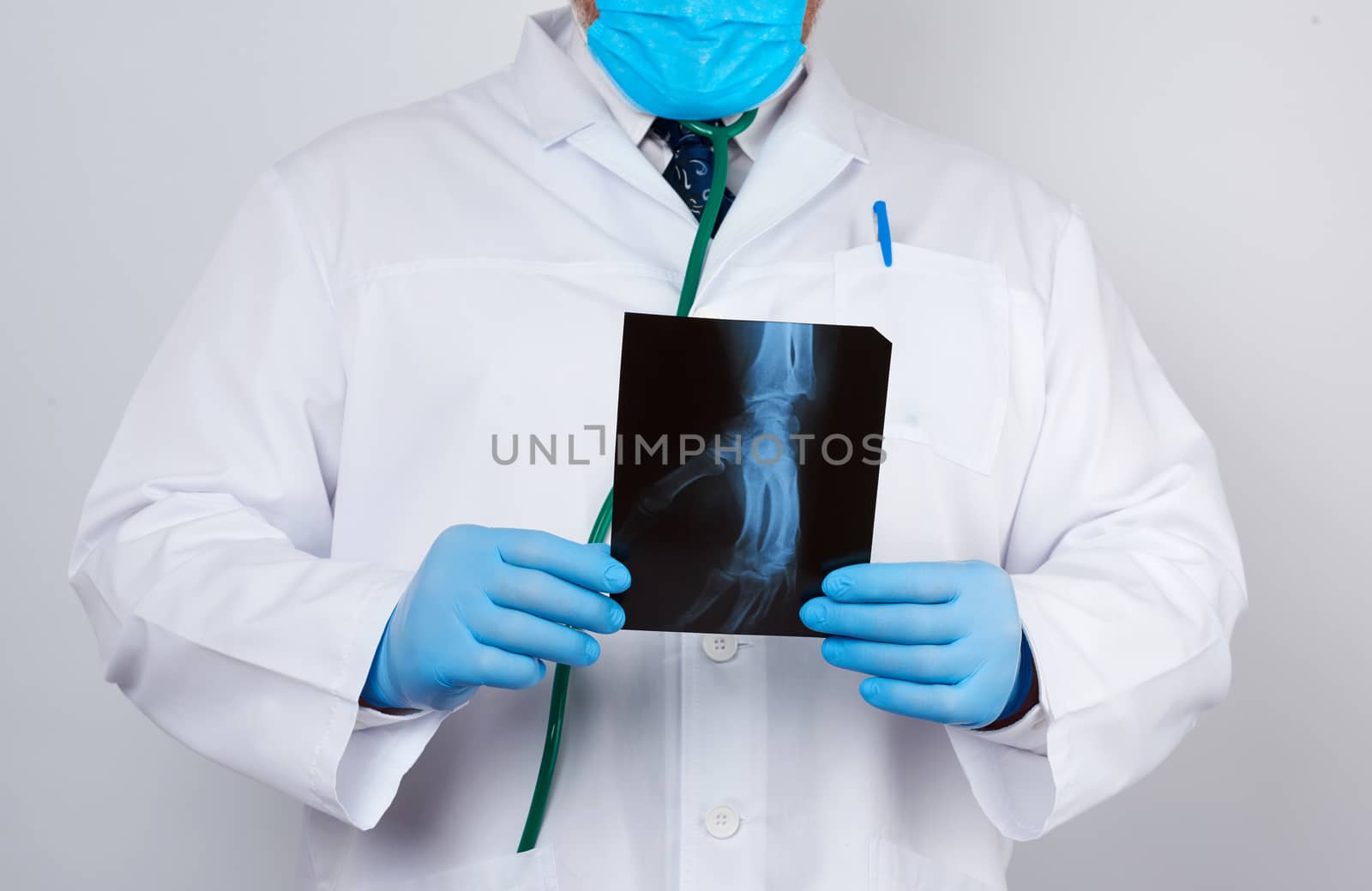 doctor in a white coat and blue latex gloves holds an x-ray of a man’s hand and conducts a visual examination, white background