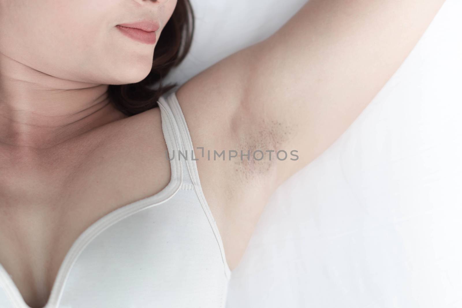 Women problem black armpit lying on white bed background for ski by pt.pongsak@gmail.com