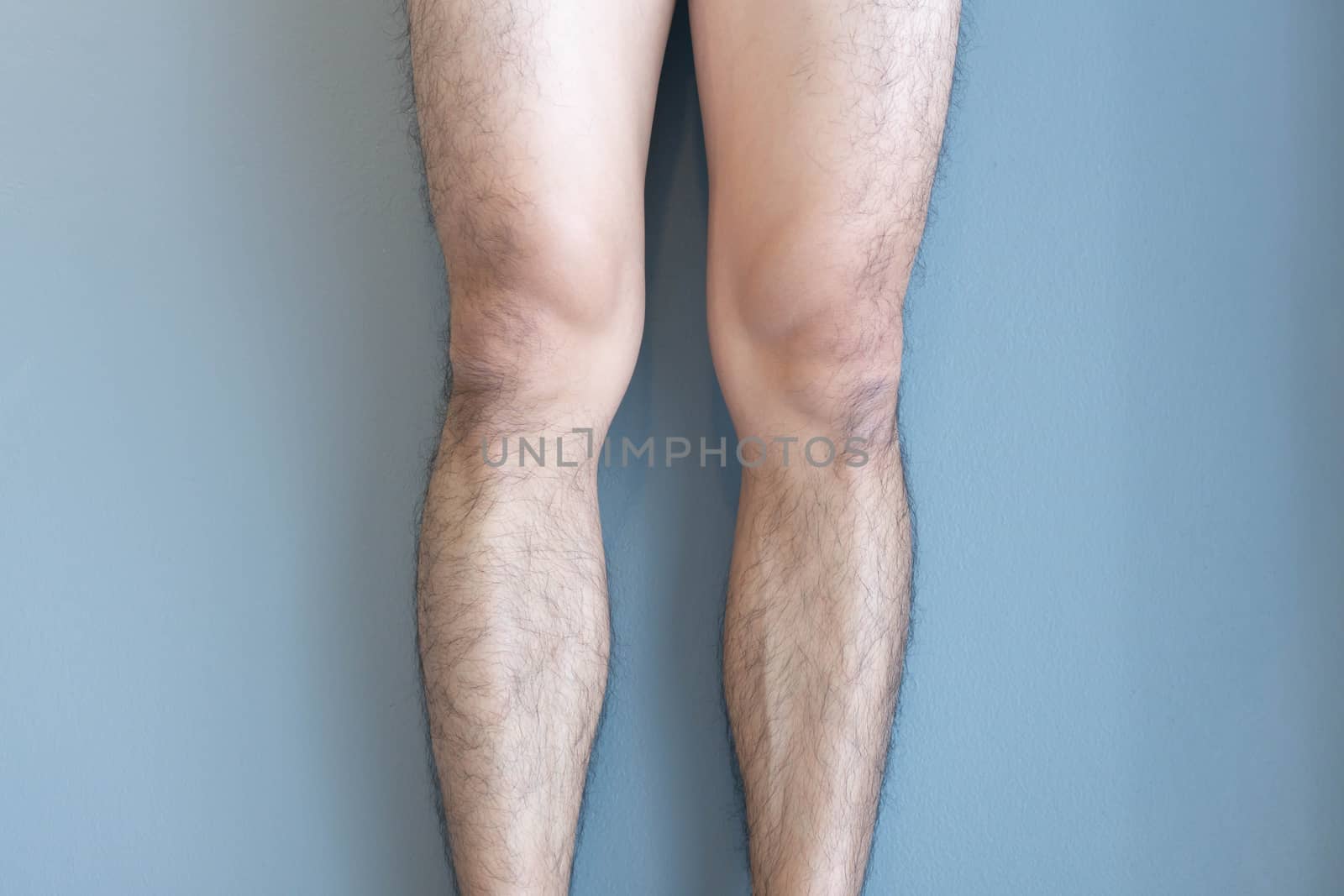 Closeup legs men skin and hairy for health care concept with gre by pt.pongsak@gmail.com