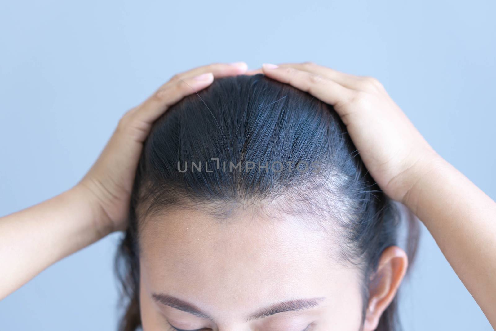 Woman serious hair loss problem for health care shampoo and beauty product concept, selective focus