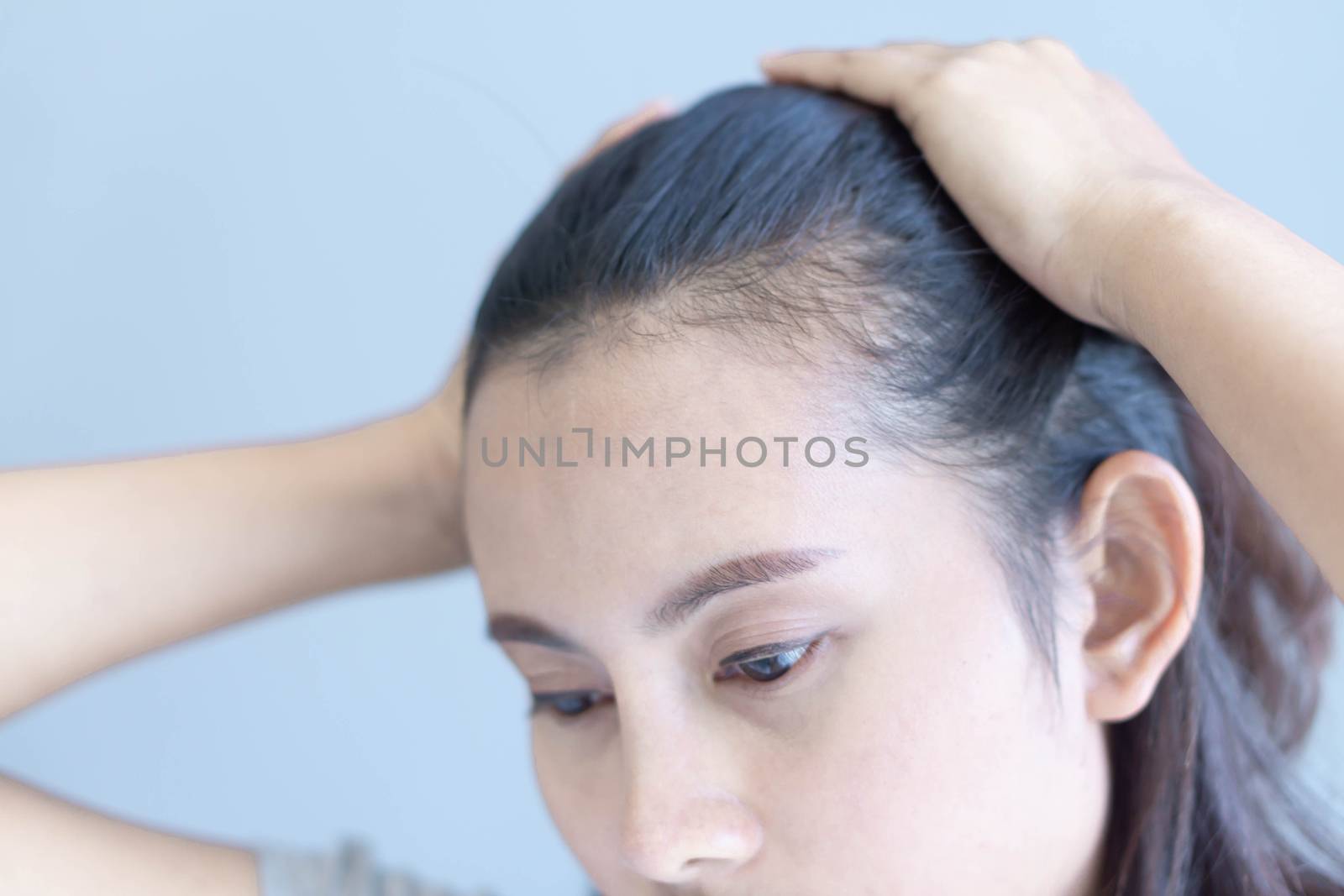 Woman serious hair loss problem for health care shampoo and beauty product concept, selective focus