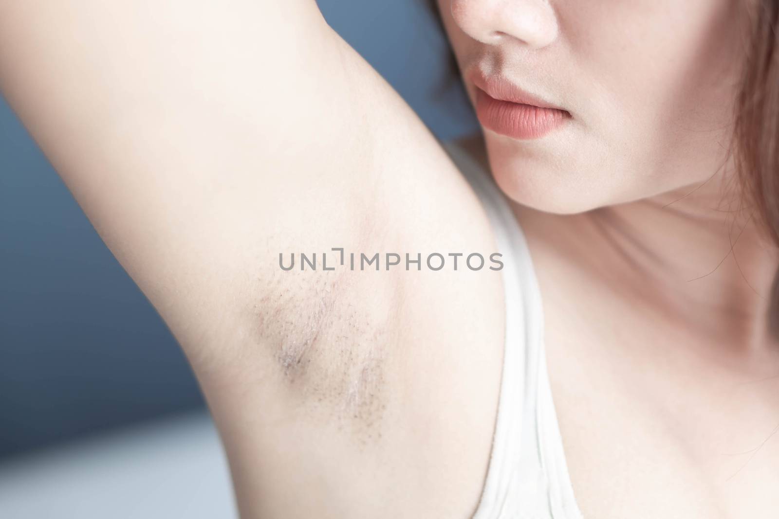 Women problem black armpit with grey background for skin care and beauty concept, selective focus