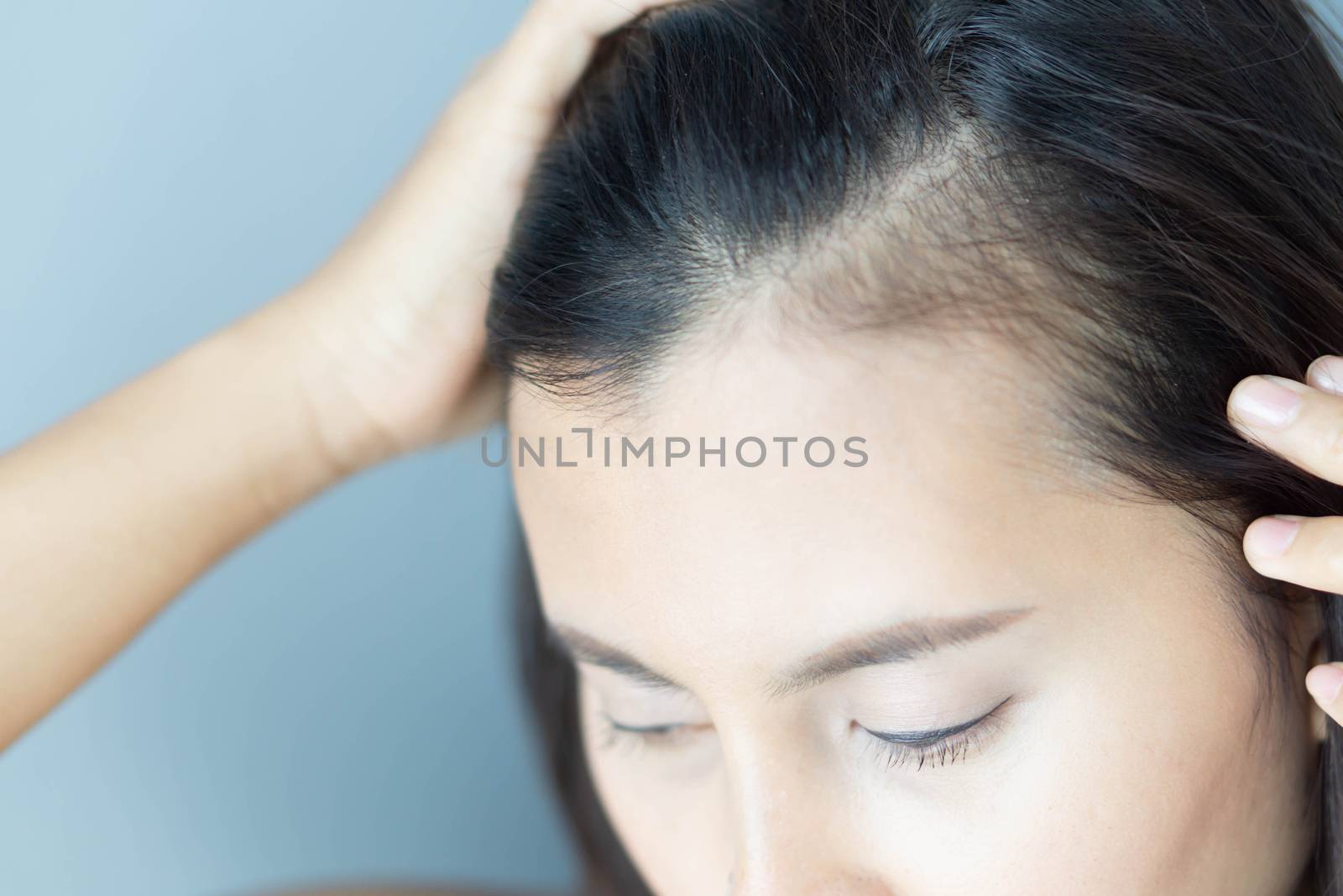 Woman serious hair loss problem for health care shampoo and beauty product concept, selective focus