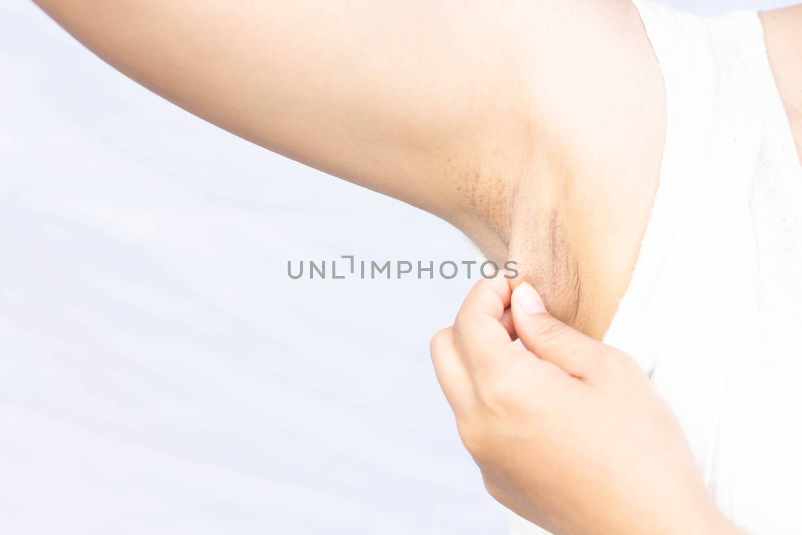 Women problem black armpit on white background for skin care and beauty concept