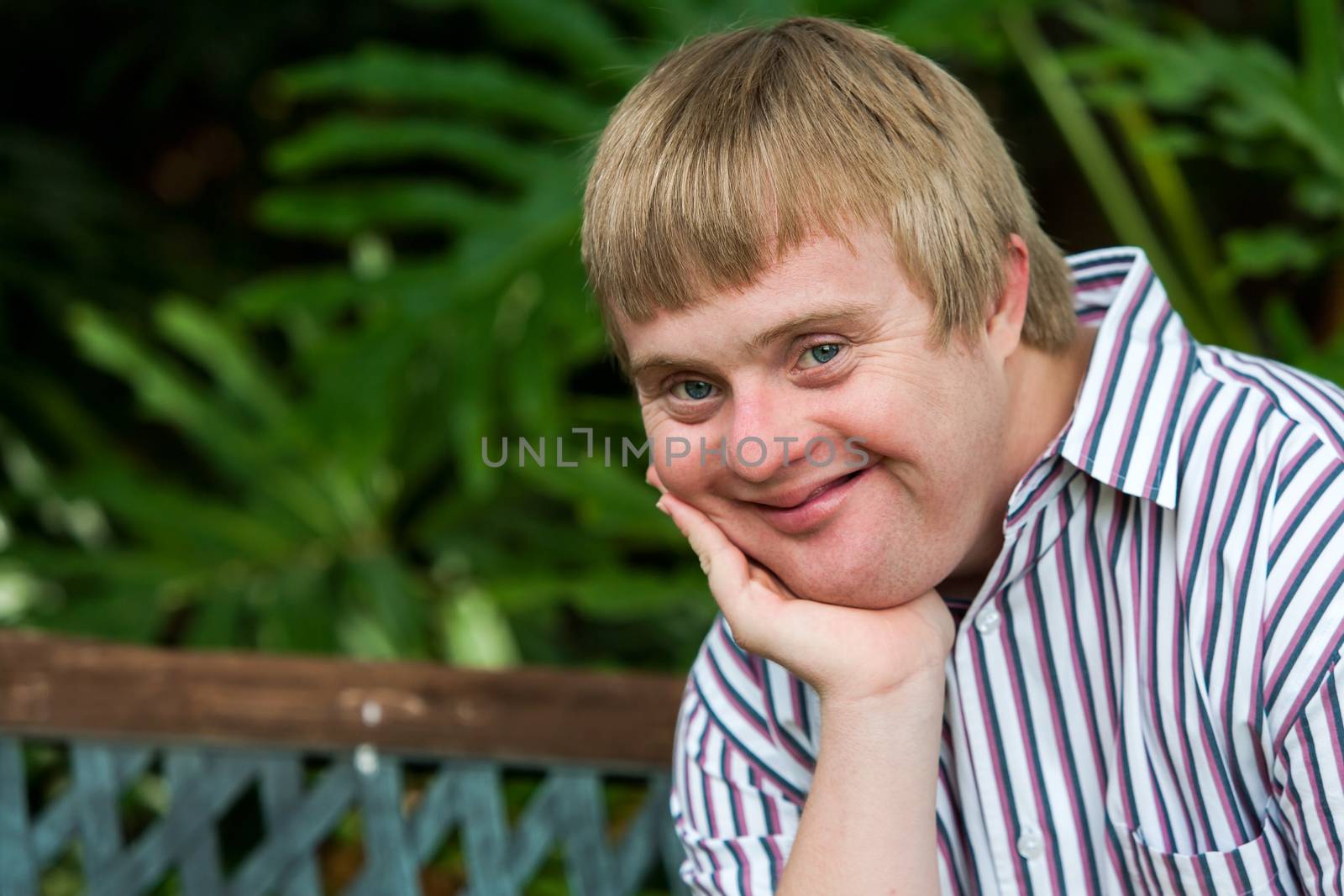 Close up facial portrait of handicapped young man outdoors resting chin on palm of hand.