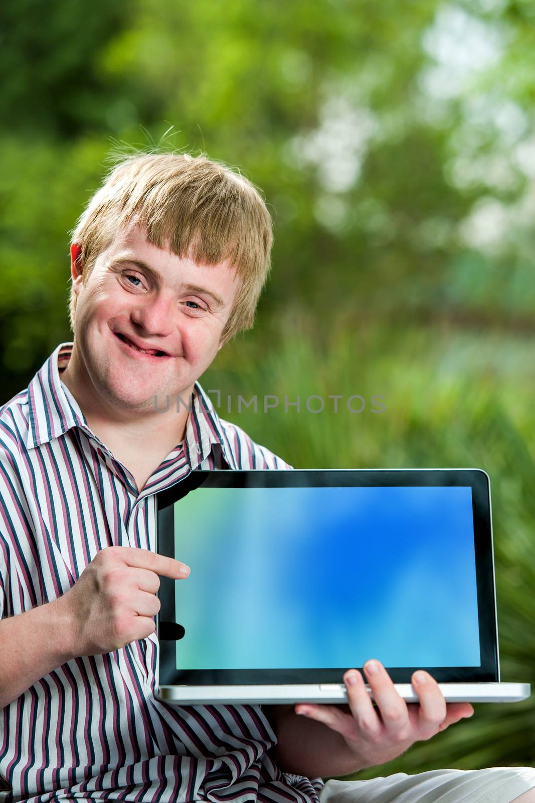 Close up portrait of handicapped student pointing at blank laptop screen against green outdoor background.