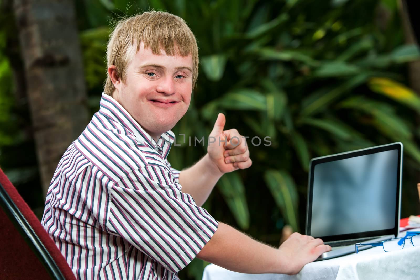 Handicapped student working on laptop. by karelnoppe