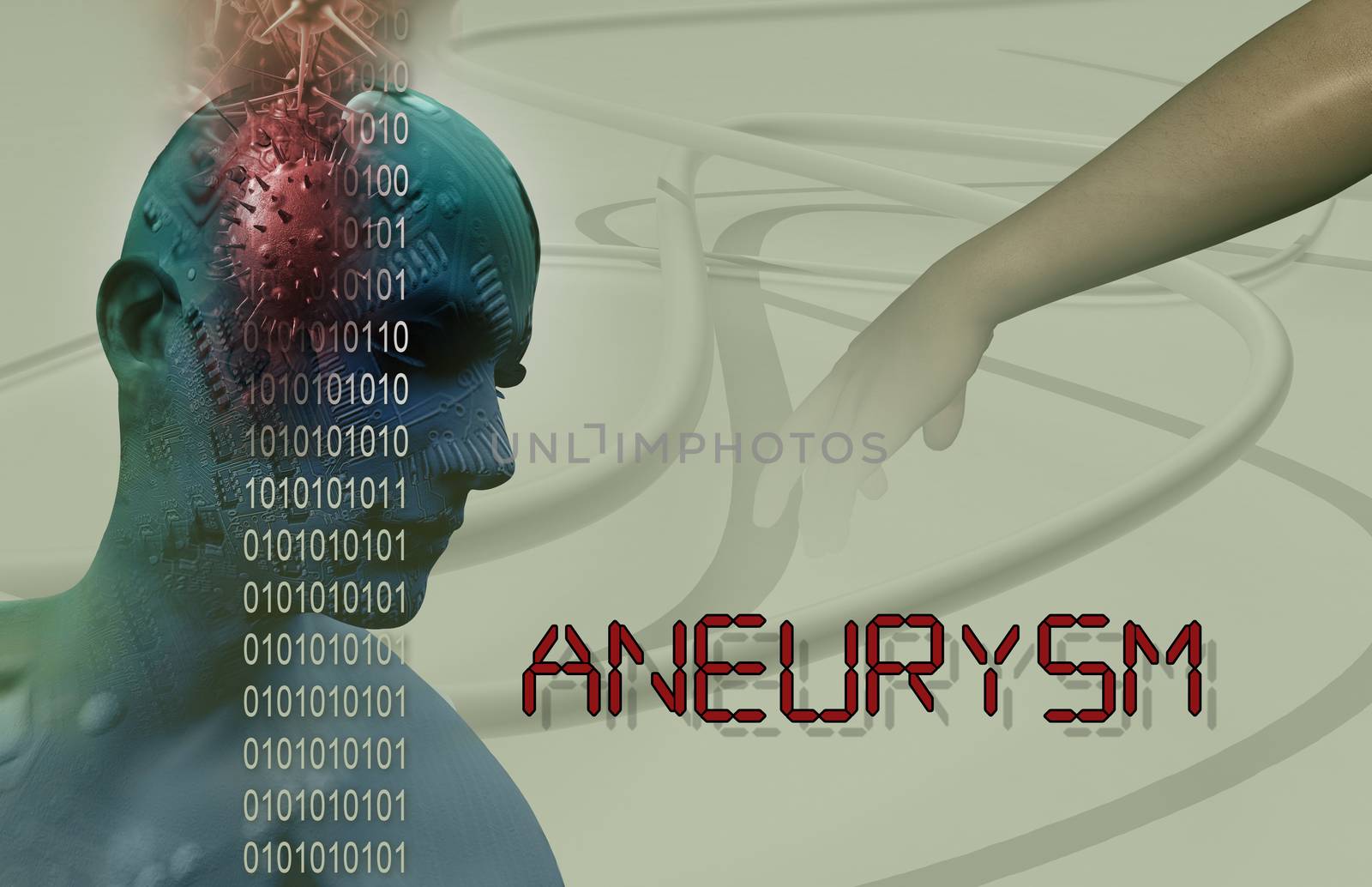 3d Medical illustration of brain aneurysm