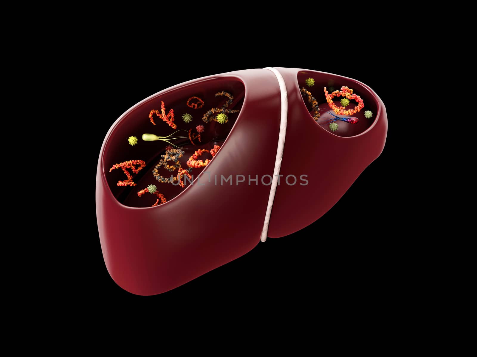 3d Rendering of Liver Infection with bacterias and viruses.