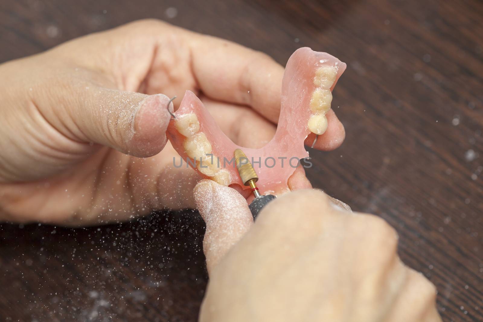 Hands of dental technician make denture prothesis in dental labo by adamr