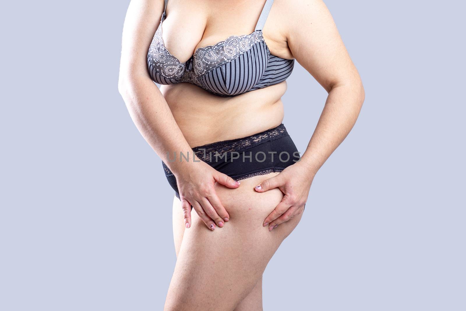 Woman Real Body Plus size Model in lingerie posign and showing fat on leg, imperfect nonideal