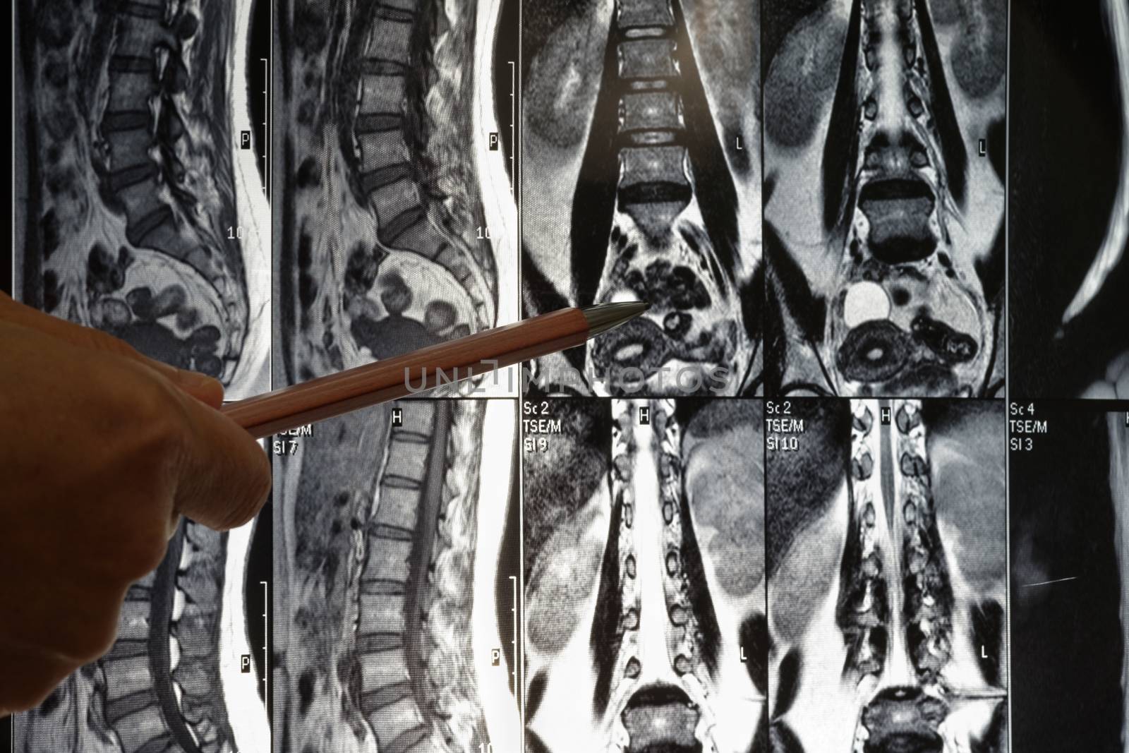 Spine x-ray film by feelartfeelant