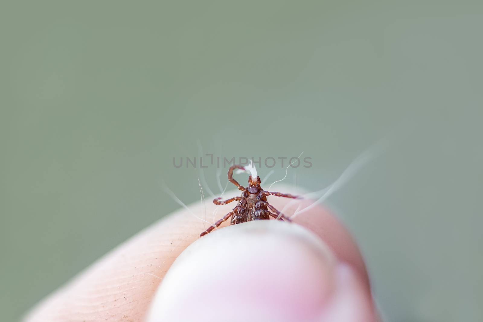 American dog tick or wood tick, dermacentor variabilis, between fingers, holding dog skin in its jaws after being pulled out of a dog