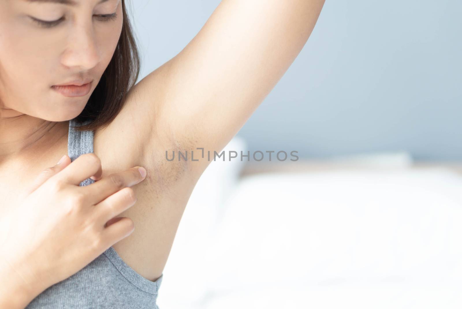 Women problem black armpit lying on white bed background for skin care and beauty concept, selective focus
