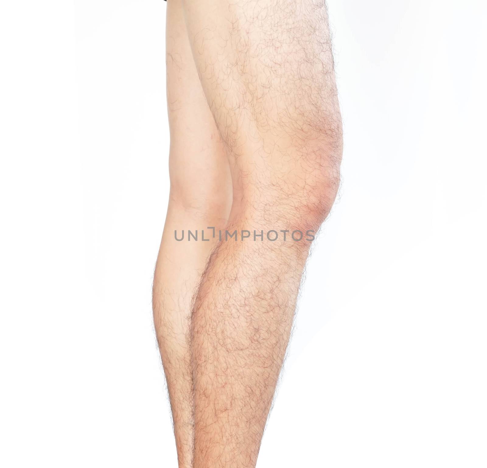 Closeup legs men skin and hairy for health care concept