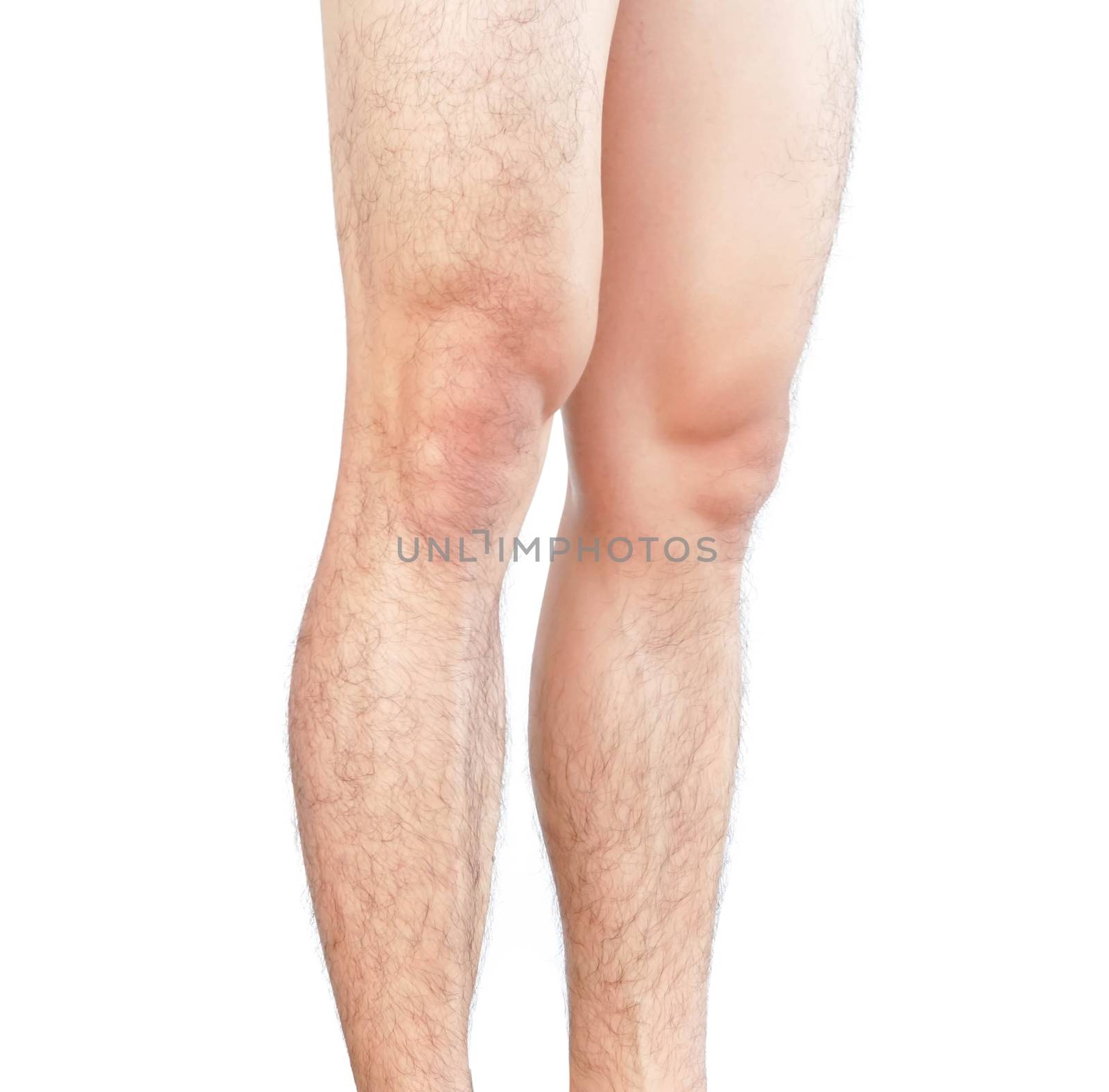 Closeup legs men skin and hairy for health care concept by pt.pongsak@gmail.com