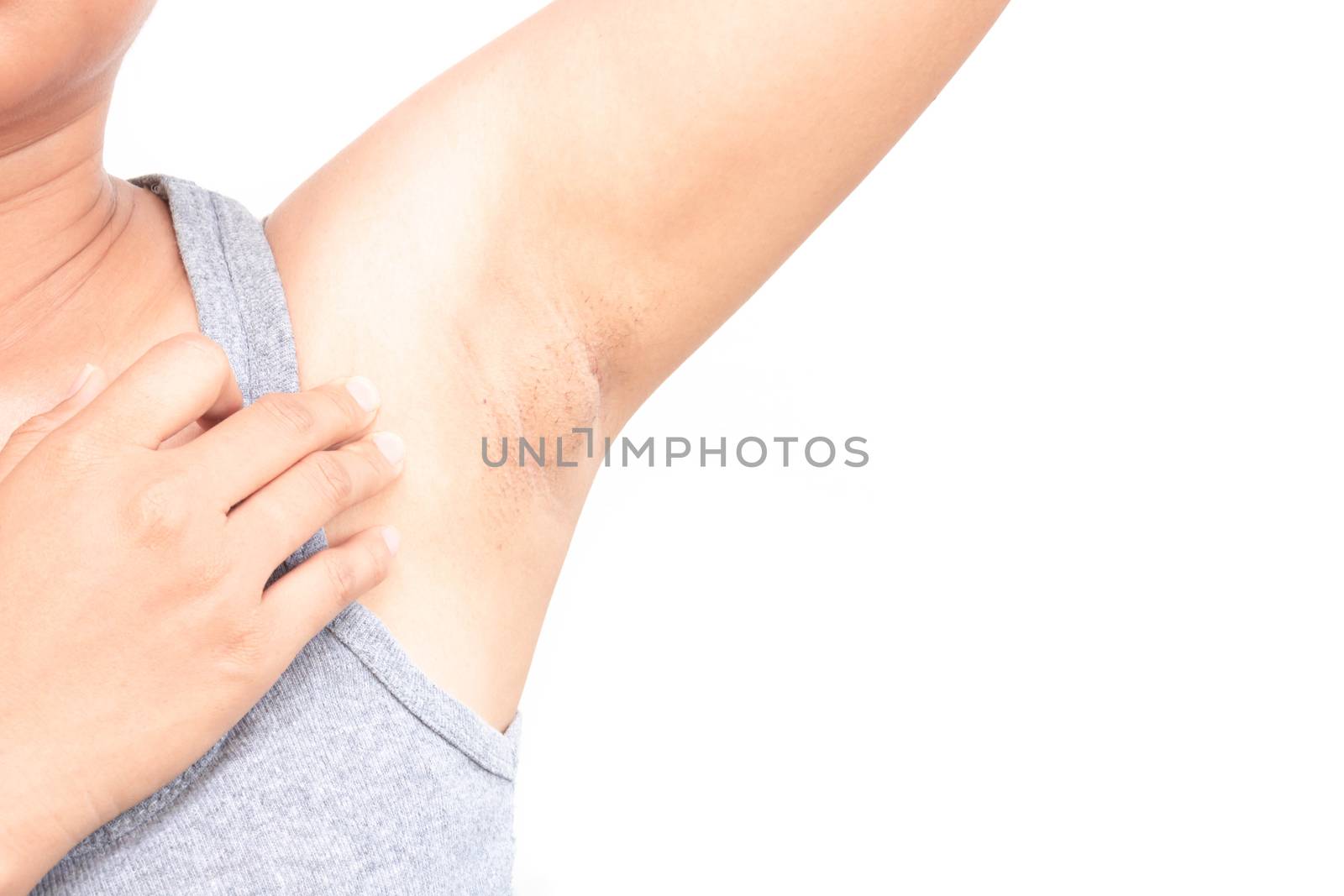 Women problem black armpit on white background for skin care and beauty concept