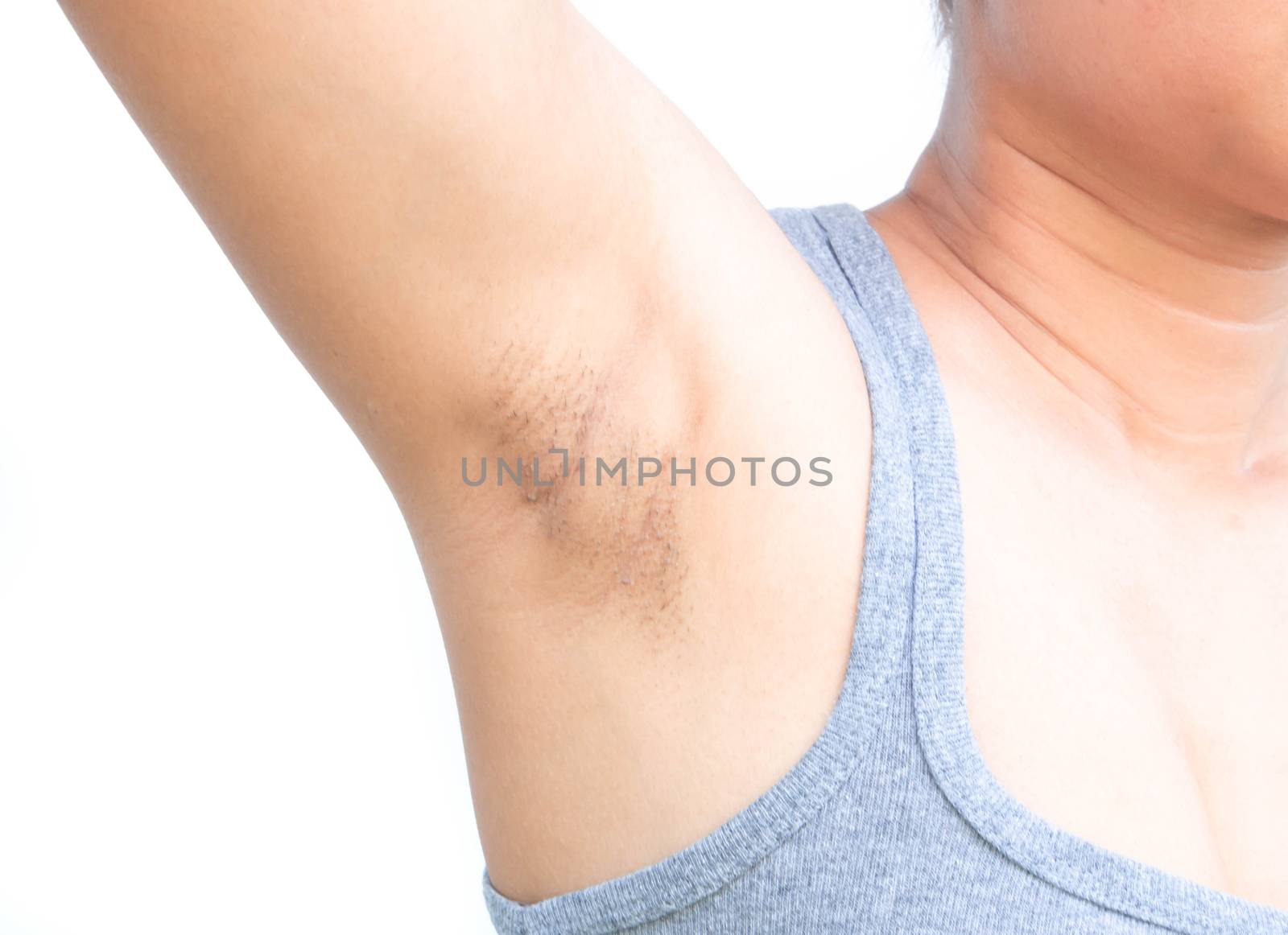 Women problem black armpit on white background for skin care and beauty concept